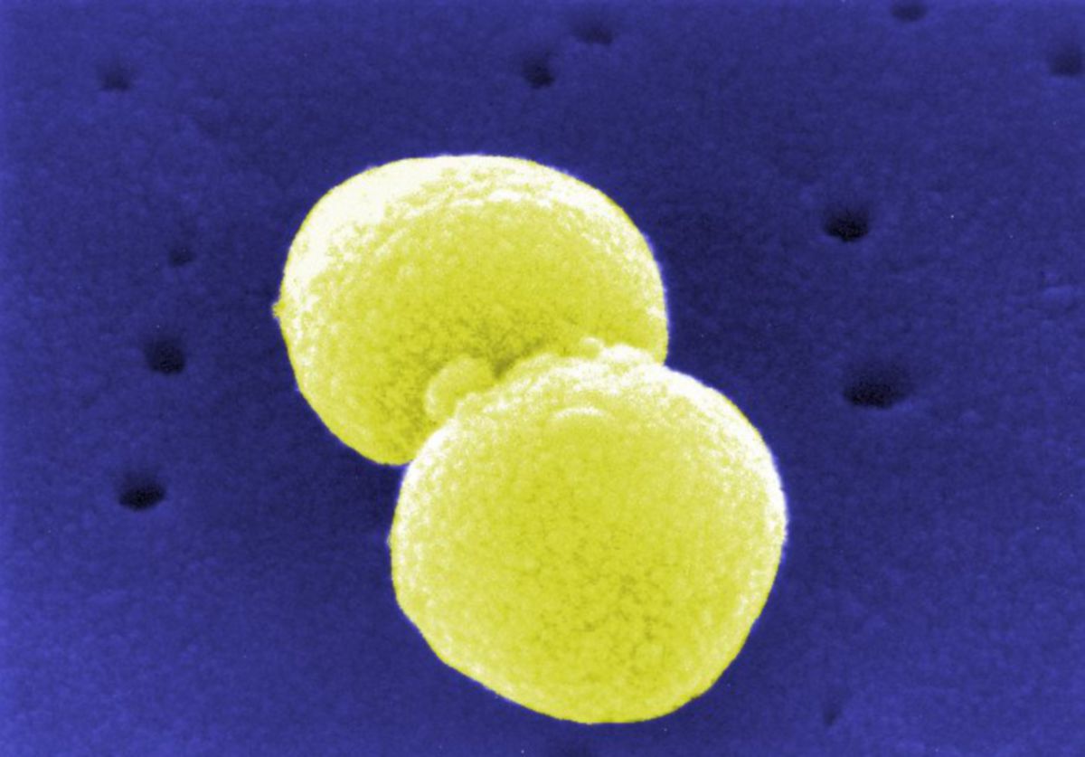 Streptococcus pneumoniae (Pneumokokken, REM-Aufnahme)