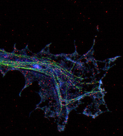 Hochauflösende Mikroskopie einer Axonterminale eines kultivierten Motoneurons: Mikrotubuli sind mit grünem Fluoreszenzfabstoff gefärbt, Stathmin in blau, Stat-3 in rot. © Preeti Yadav, Michael Sendtner, Markus Sauer, Universität Würzburg