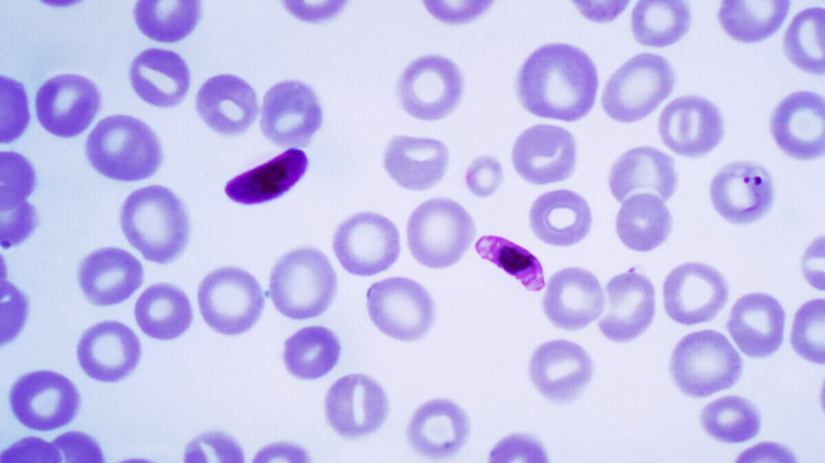 Plasmodium falciparum