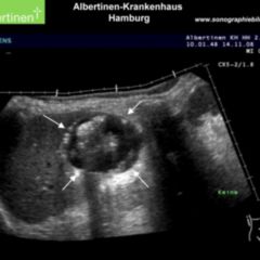 Caudal - DocCheck Flexikon