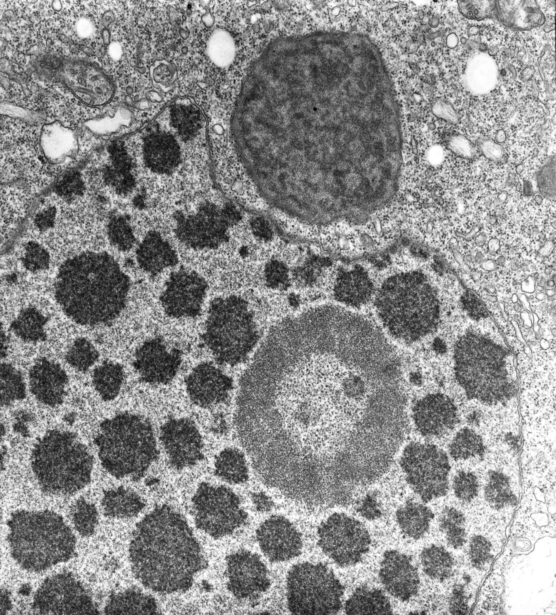 Halteria grandinella (Nuclear chromatin) - CIL:7600