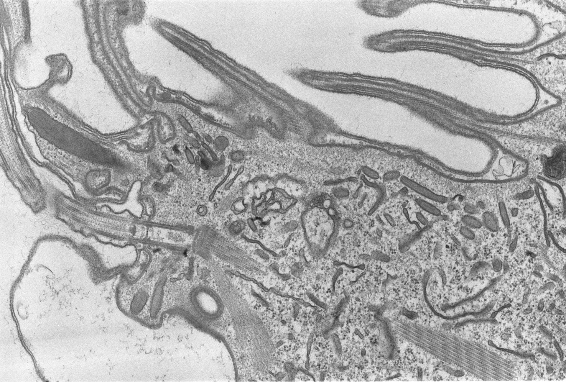 Coleps hirtus (Actin cytoskeleton) - CIL:2872