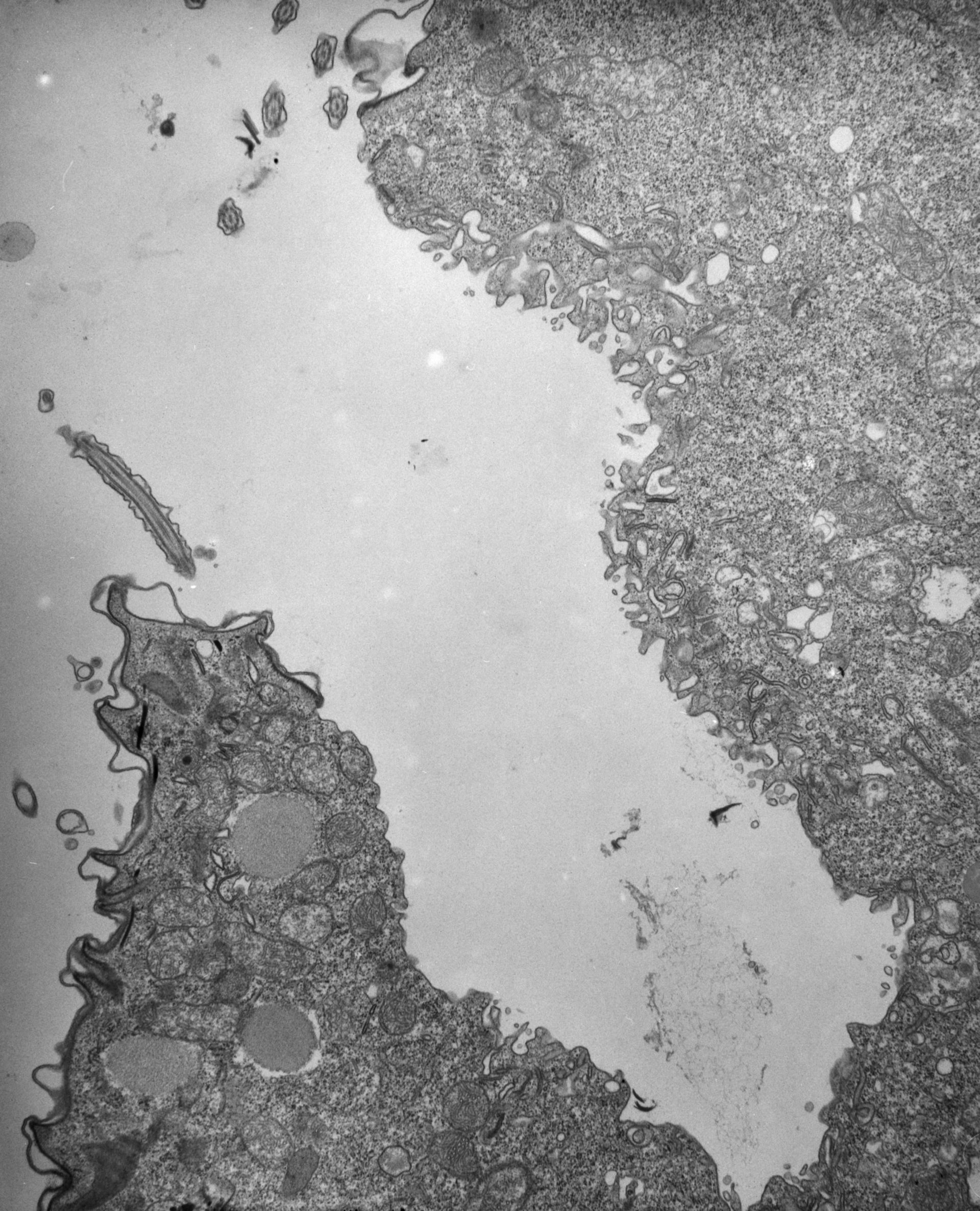 Paramecium multimicronucleatum (Cytoplasm) - CIL:12344