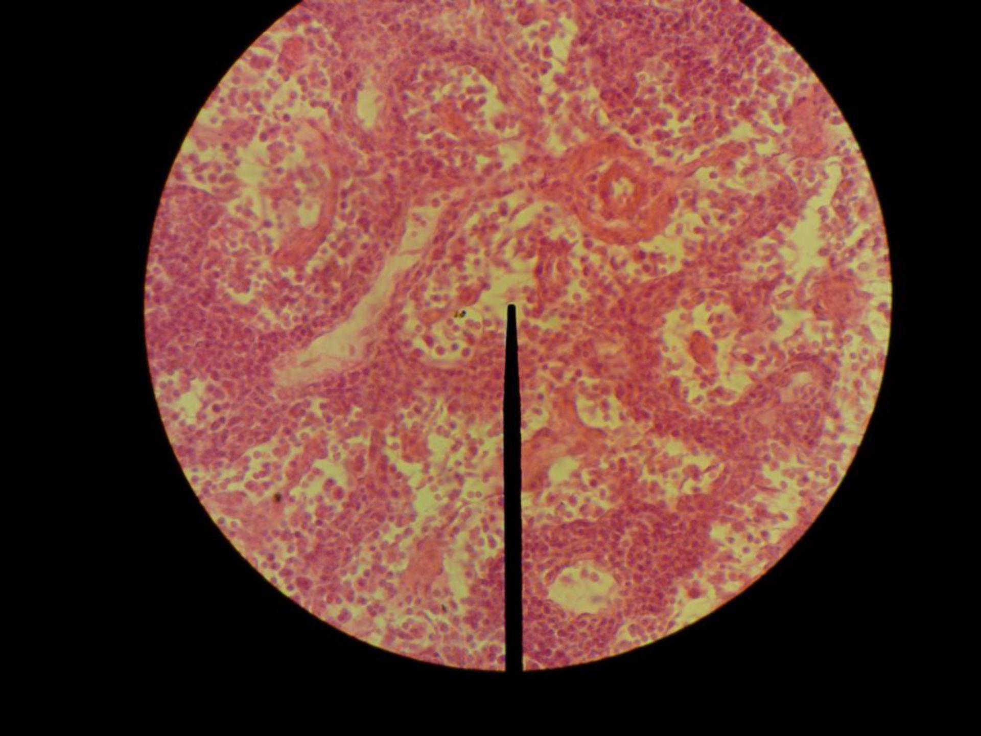 Retikuläres Bindegewebe - Lymphknoten Ziege