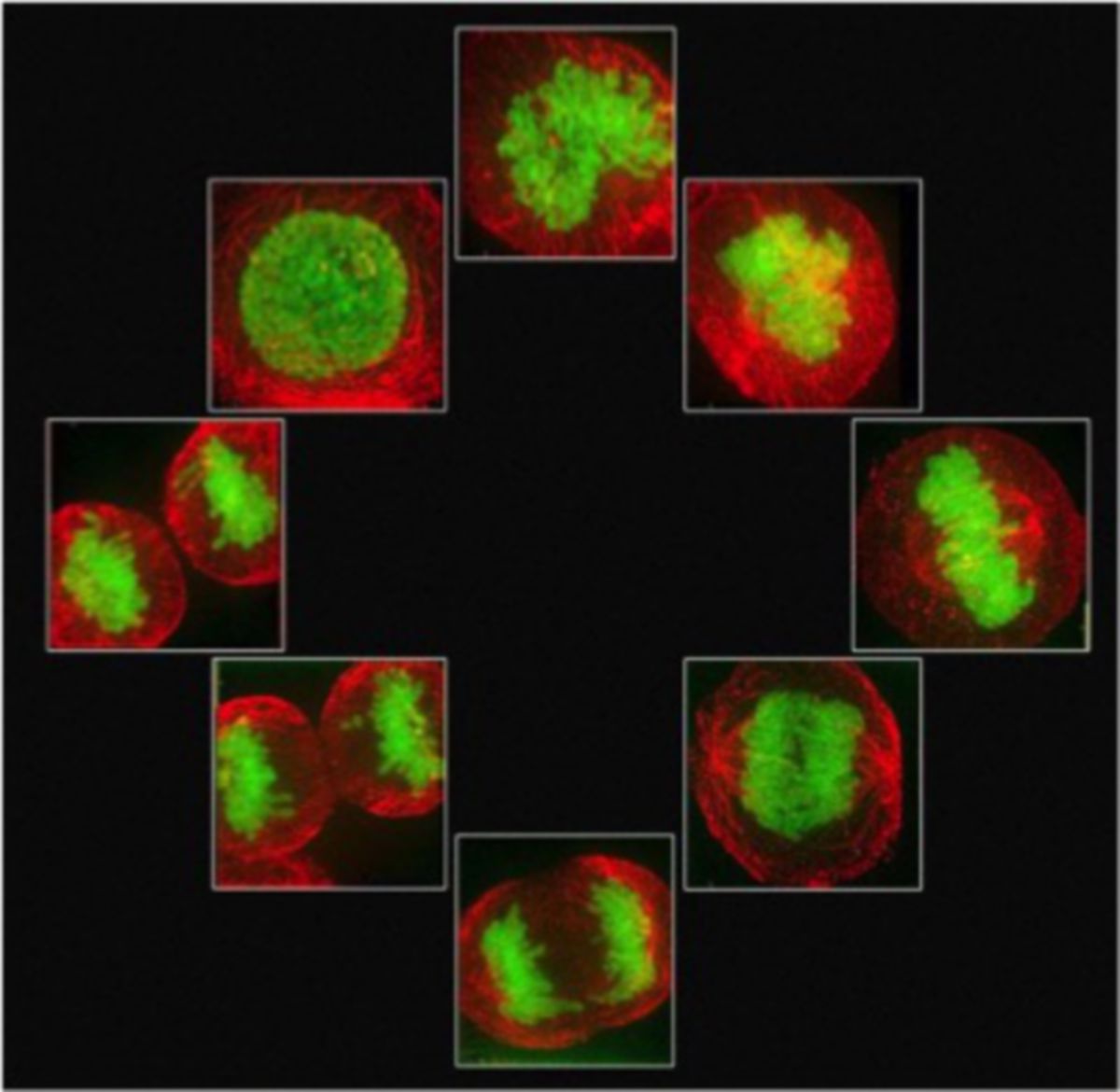 Menschliche HeLa-Krebszellen in unterschiedlichen Phasen der Mitose