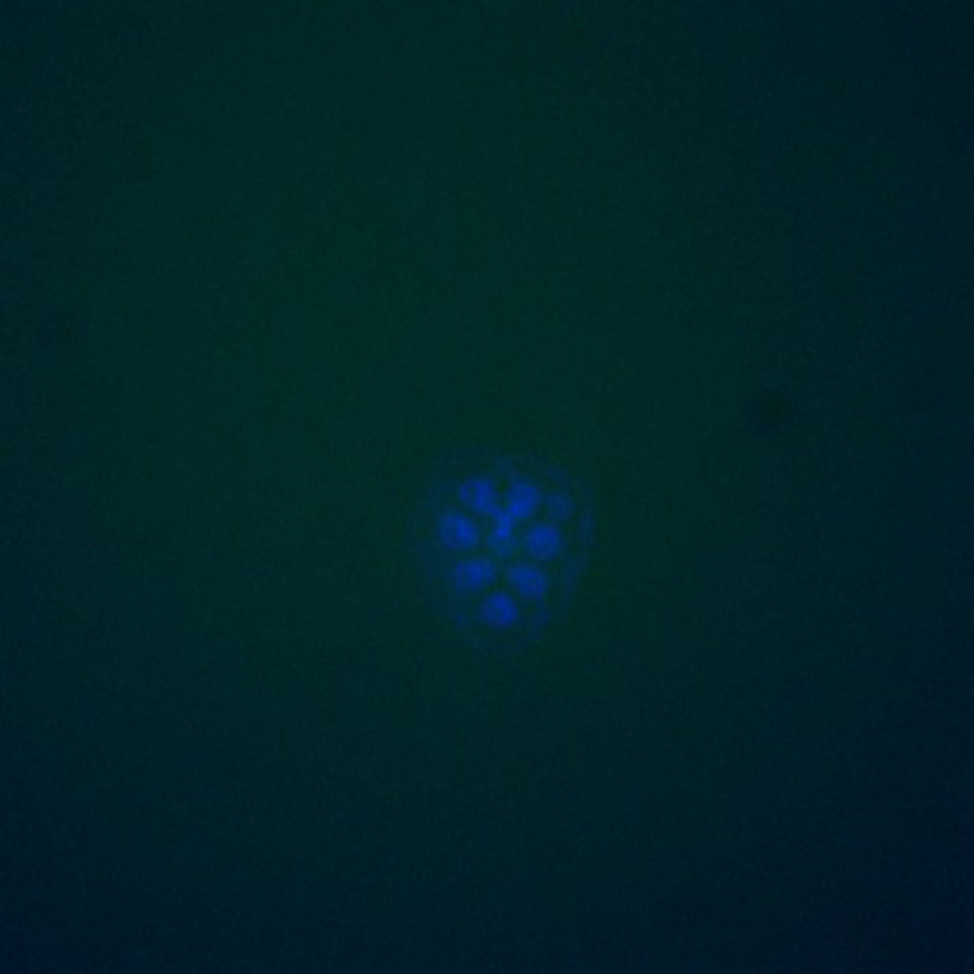 Saccharomyces cerevisiae (DNA replication preinitiation complex) - CIL:39533