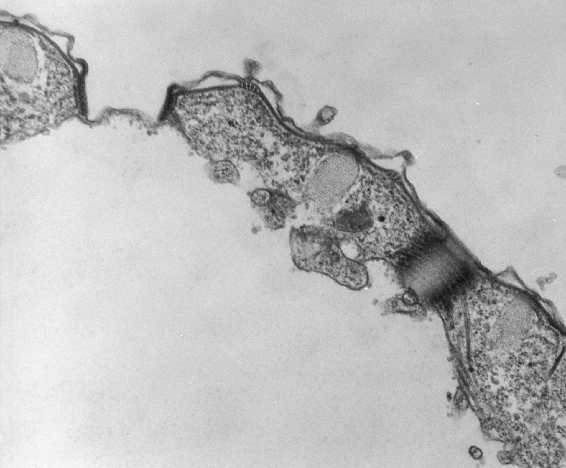 Tetrahymena pyriformis (Cell cortex) - CIL:39794