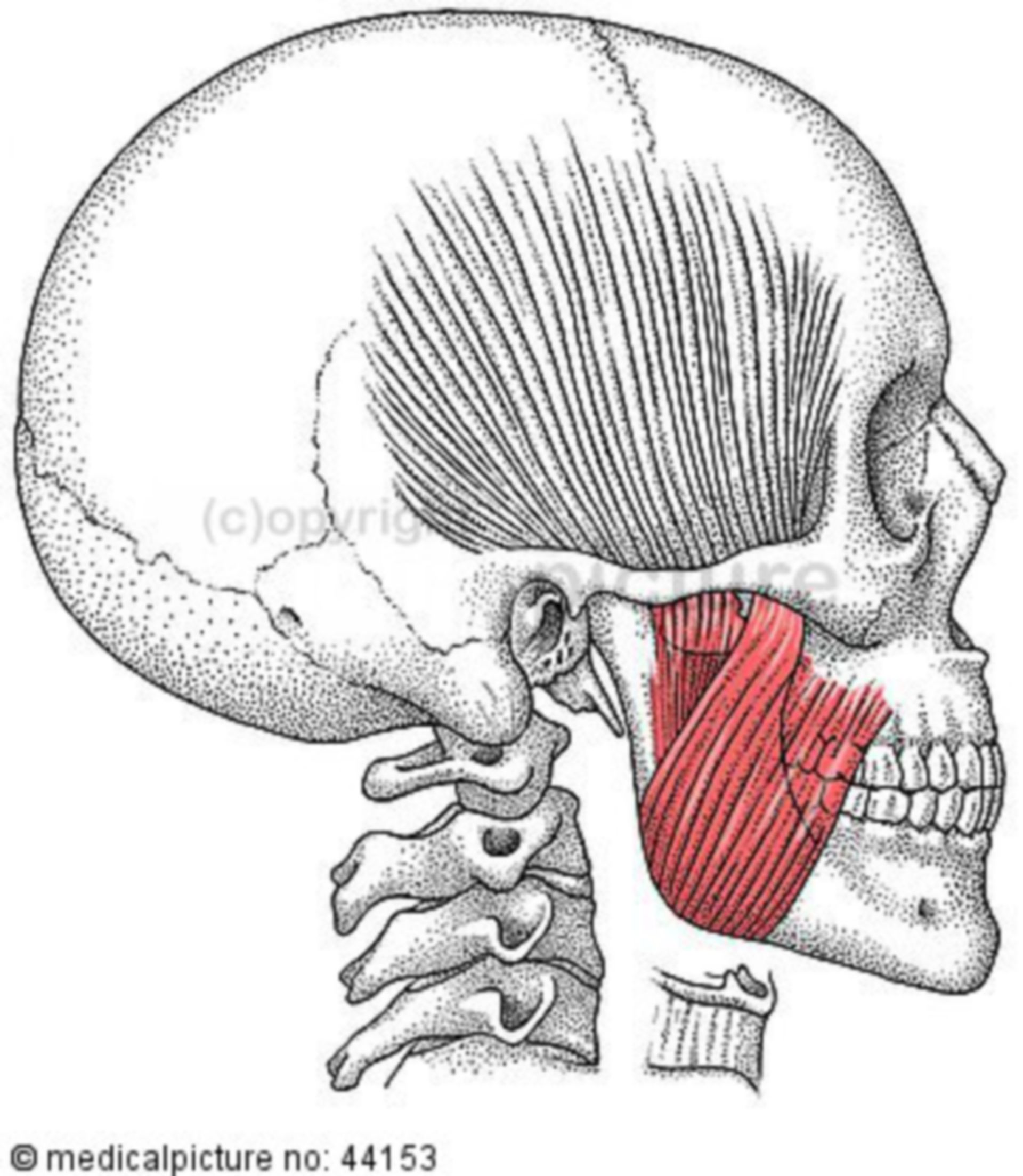 Cranium with Masseter Muscle