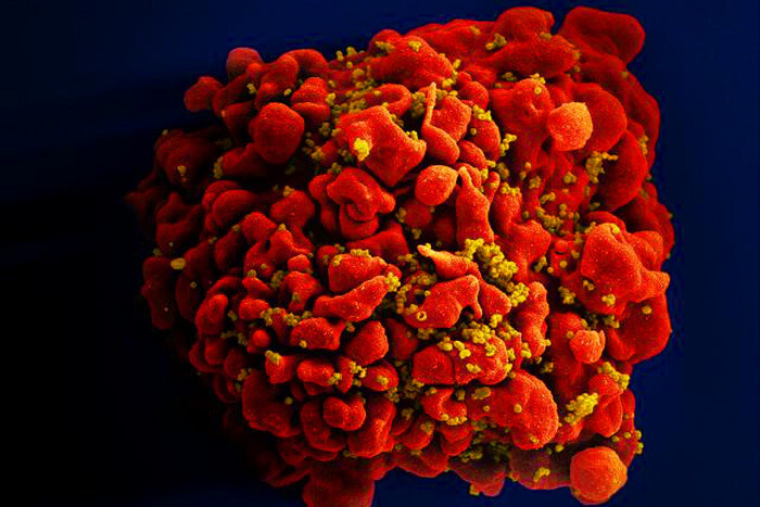 low-res_hiv_and_aging__2_.jpg_original.jpg