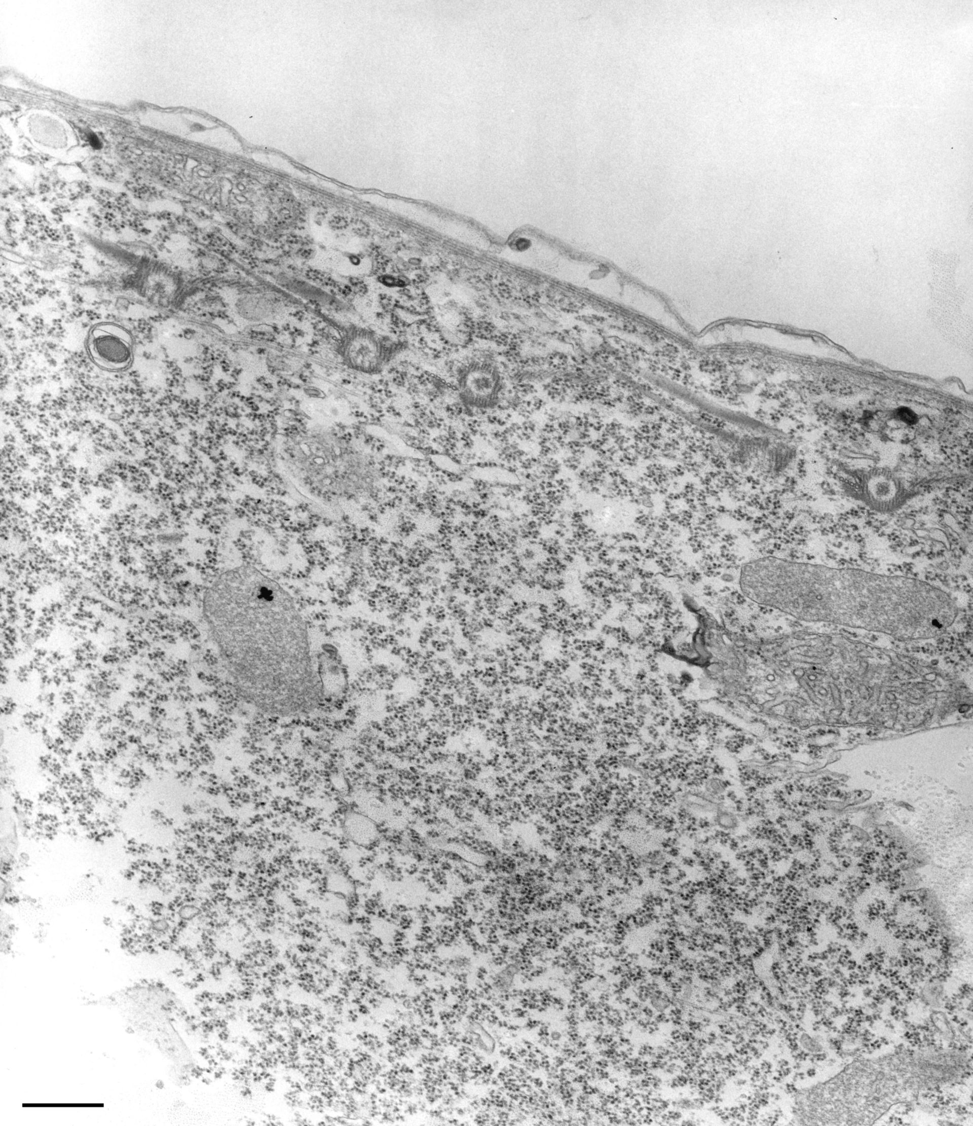 Tetrahymena pyriformis (Fibril) - CIL:36242