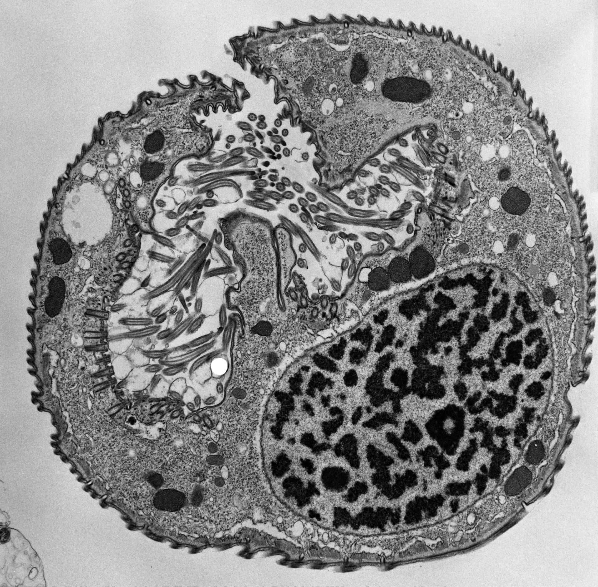 Opercularia coarctata (citoplasma) - CIL:39170