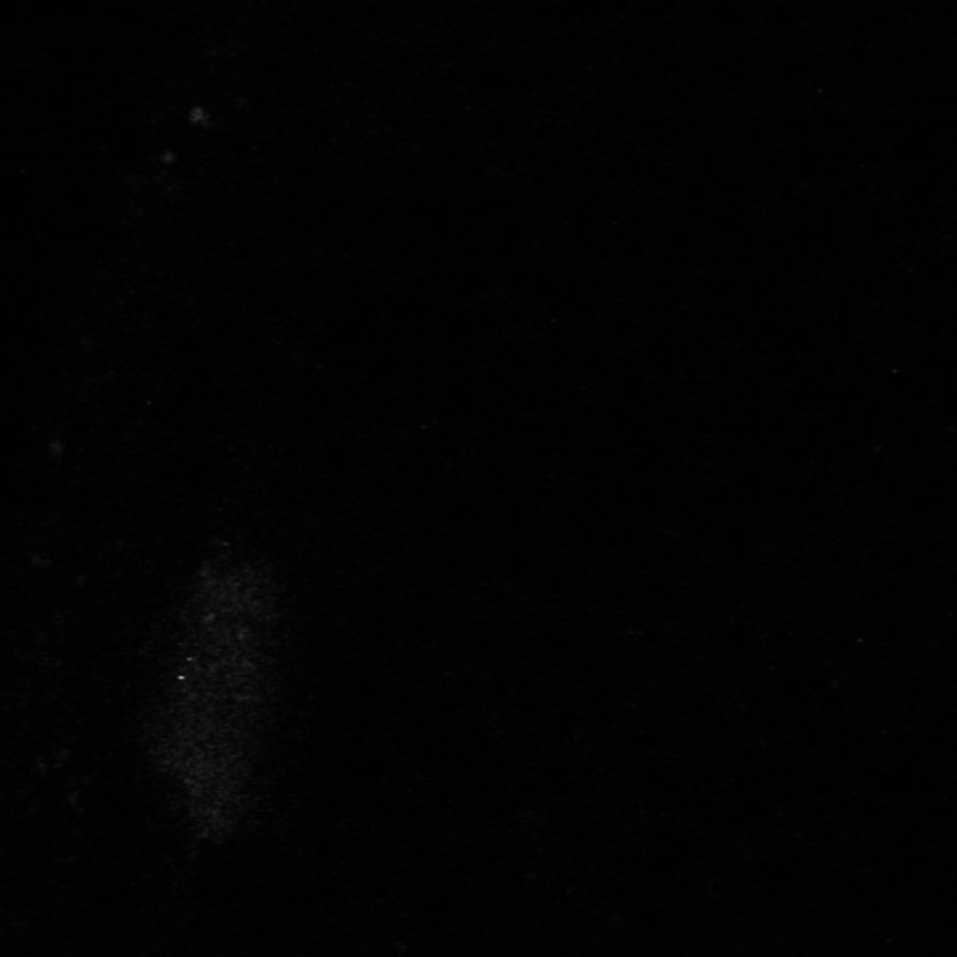 Xenopus laevis (Axon) - CIL:36902
