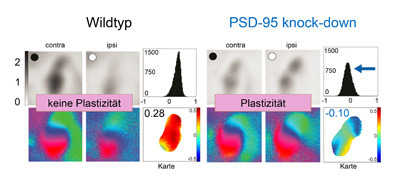 Neuronale Plastizität bei Mäusen mit normaler Expression von PSD-95 (Wildtyp) und erwachsenen Mäusen mit herunterregulierter Expression von PSD-95 (PSD-95 knock down, rechts). © umg_pug