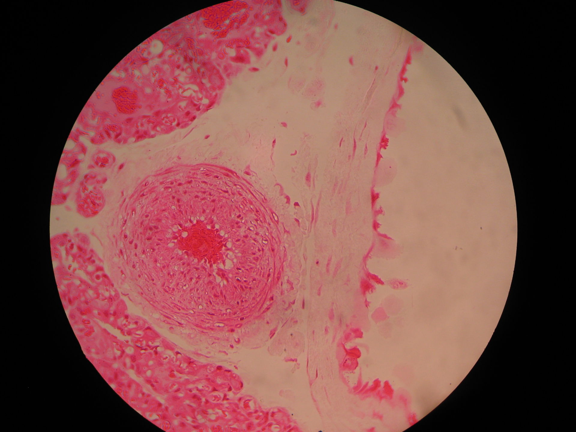 Veterinary Medicine: Cross-section Placenta of a dog (5) - Vessels in Chorion Plate