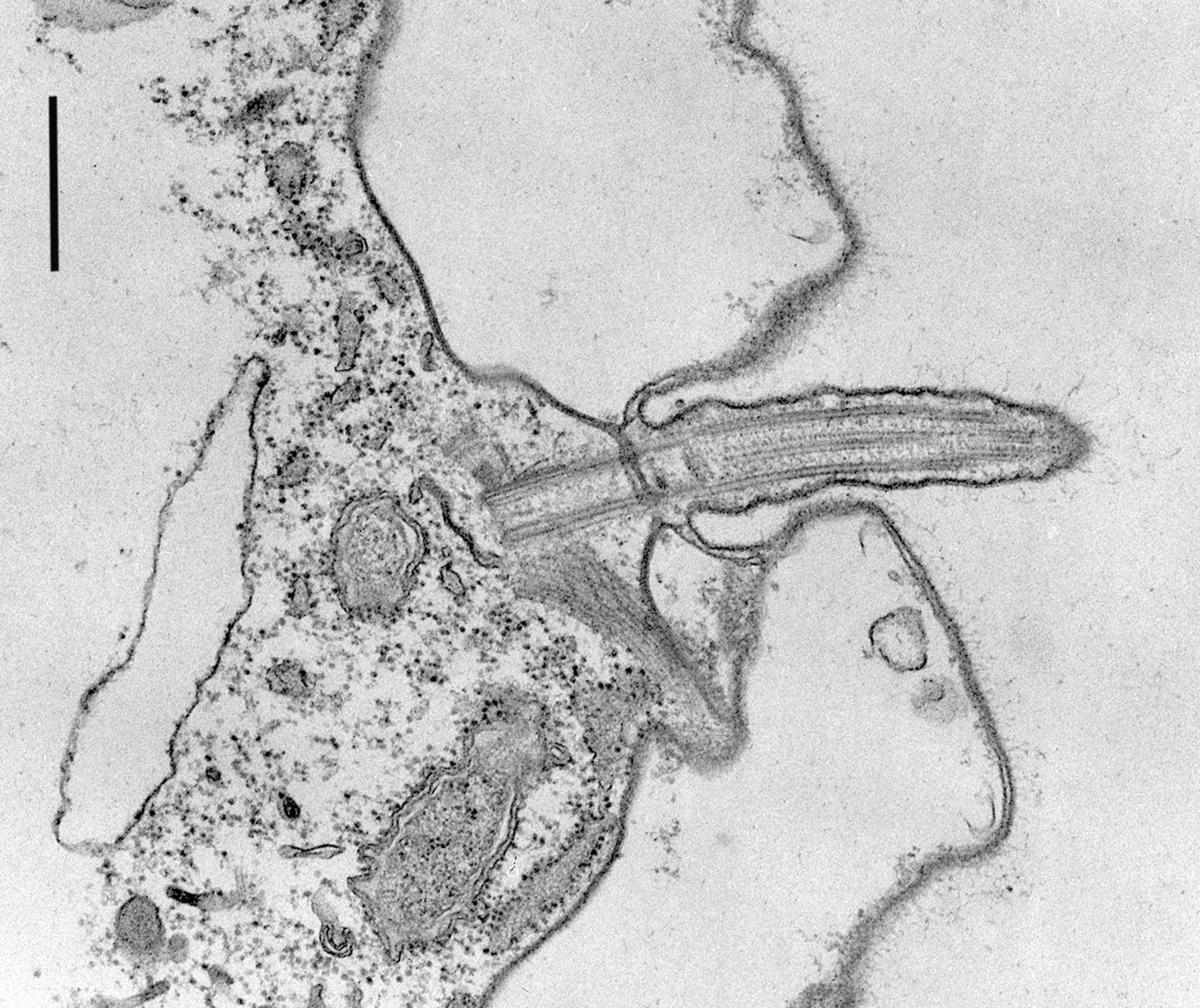 Coleps hirtus (Bacteroid-containing symbiosome) - CIL:9718