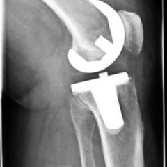 TEP - DocCheck Flexikon