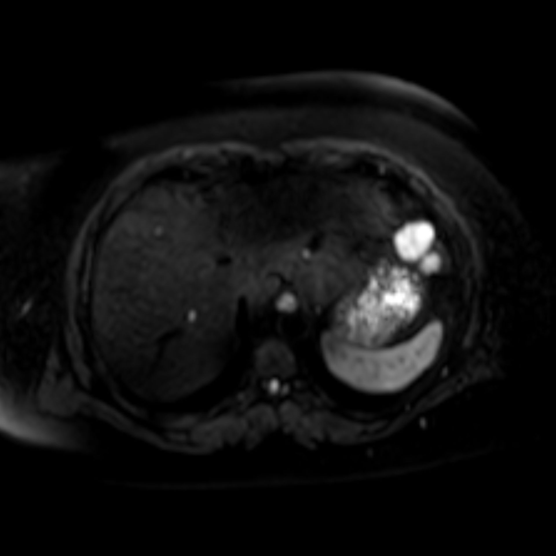 mrt_diff7: MRT-Diffusionsaufnahme in transversaler Ebene