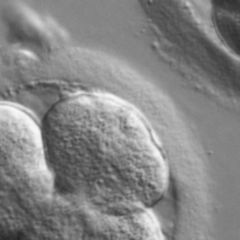 Spermium DocCheck Flexikon