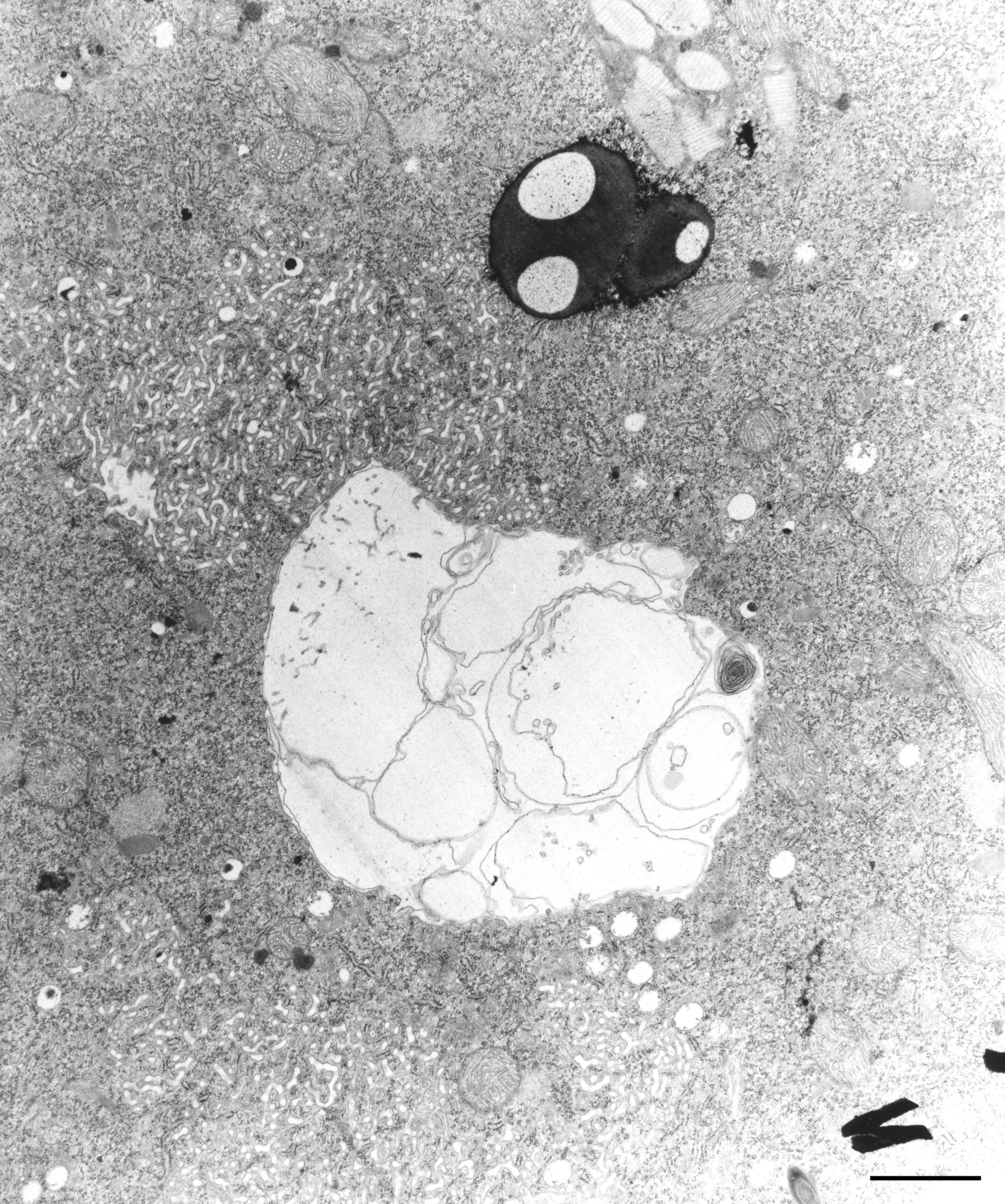 Didinium nasutum (Extrusomes) - CIL:12304