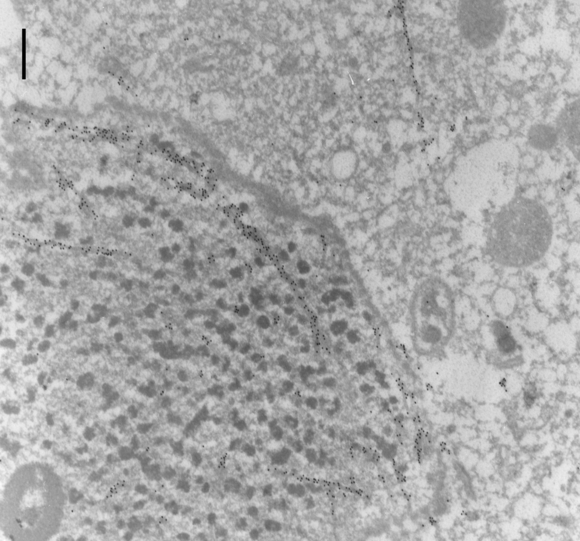 Paramecium tetraurelia (Cytoplasm) - CIL:9859