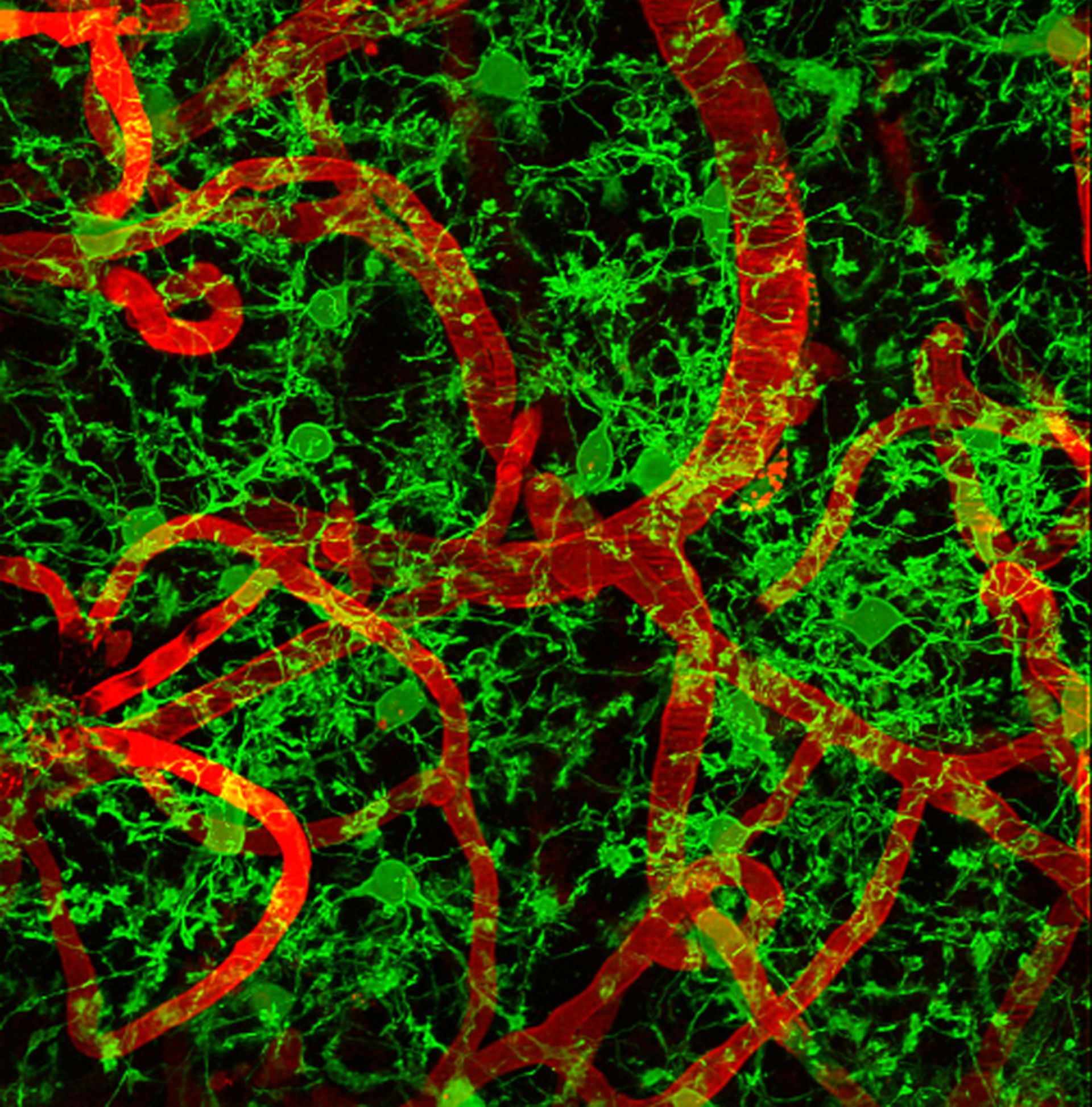 Multiphoton Bild von aktivierte Mikroglia (GFP, grün) und zerebrale Blutgefäße (Texas rot)