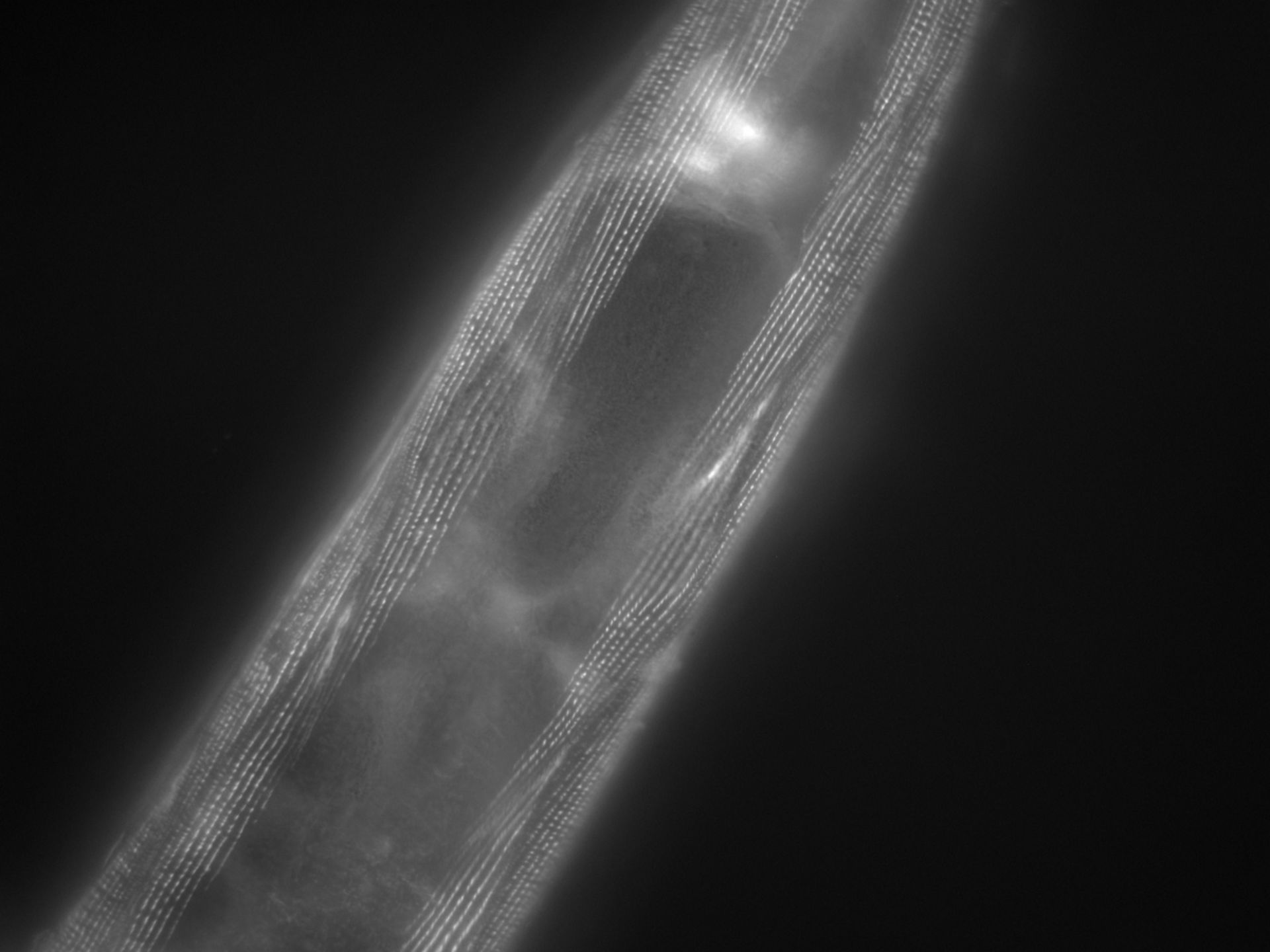 Caenorhabditis elegans (Actin filament) - CIL:1175