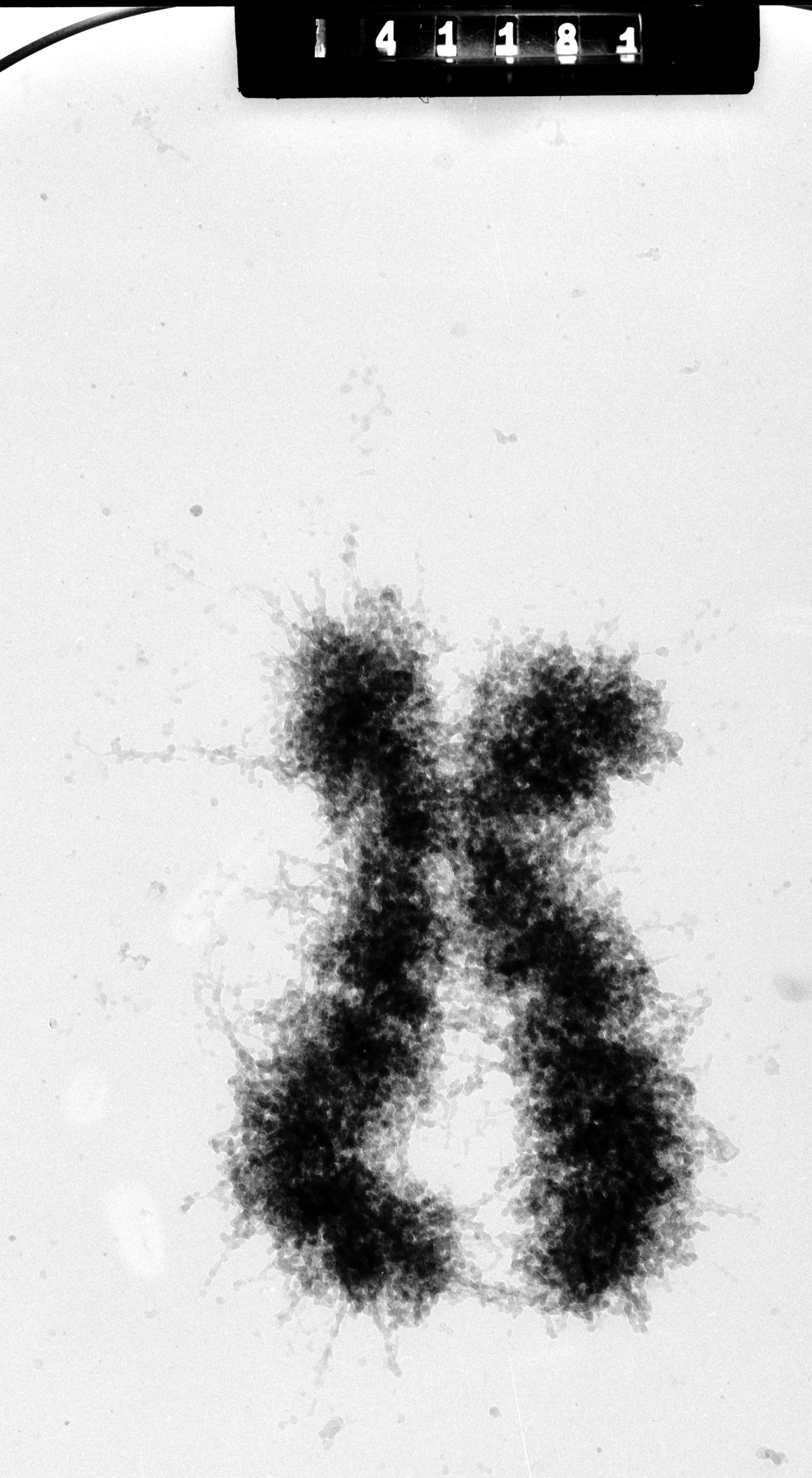 Homo sapiens (Condensed chromosome) - CIL:35370
