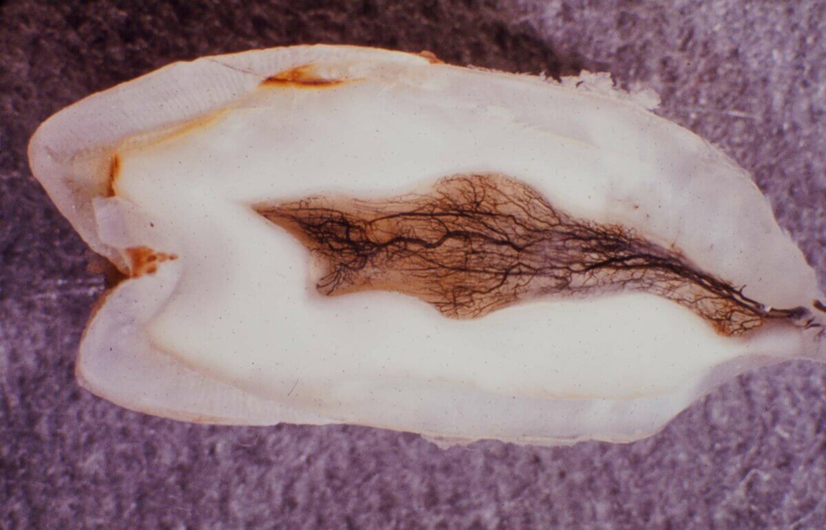 Querschnitt Prämolar