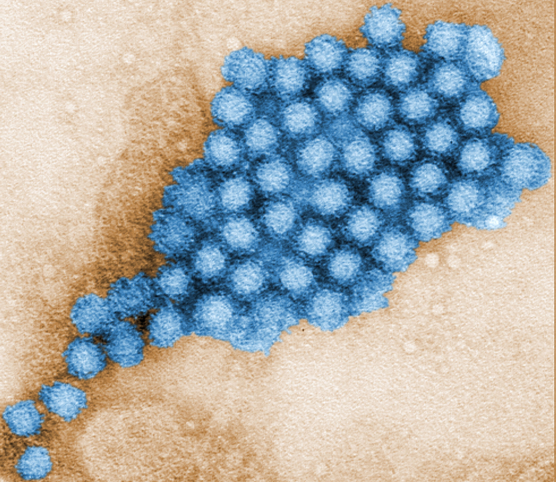 Norovirus (TEM, colorized) 2