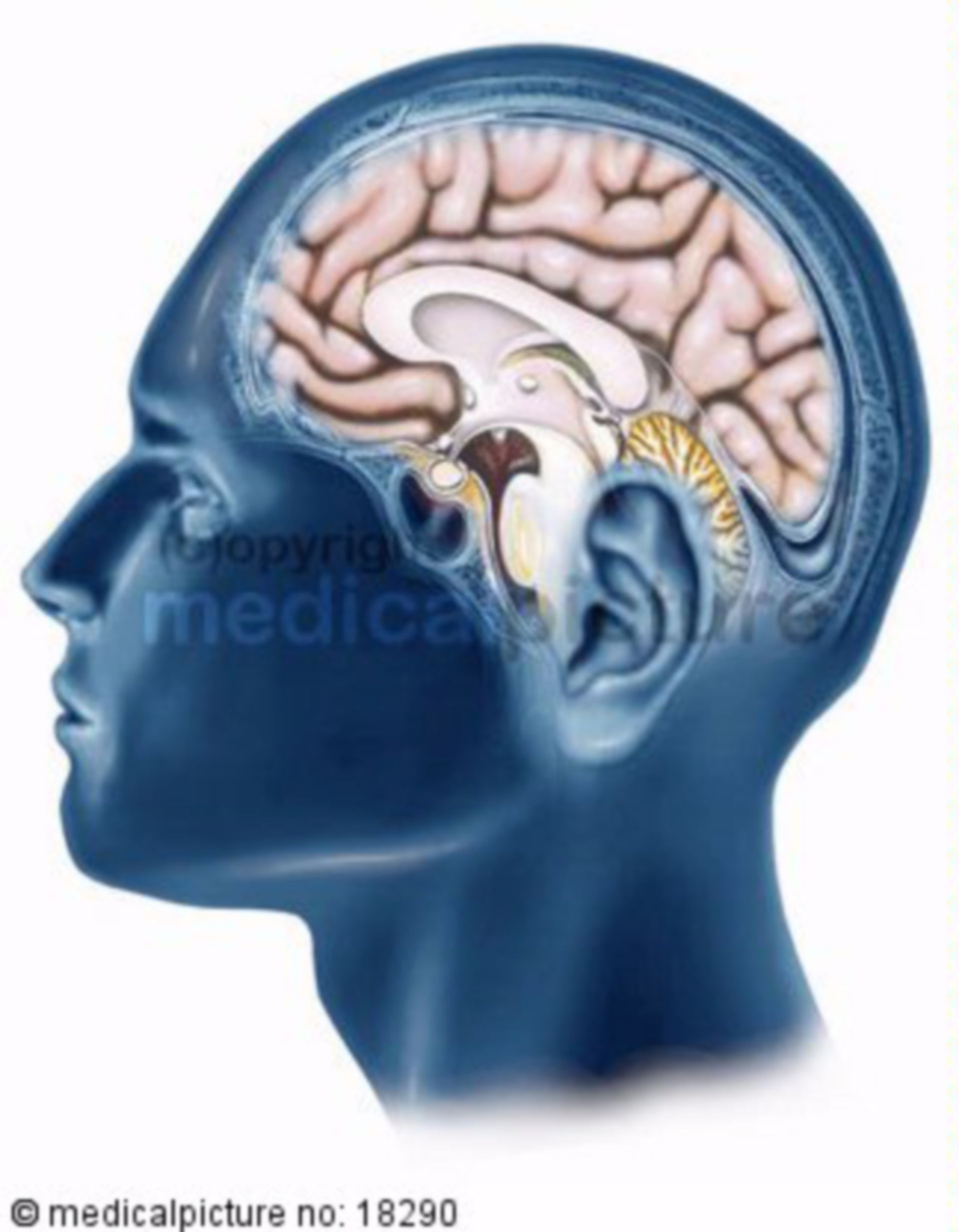  Gehirn in einfarbigem Kopf, brain in single-colored head 
