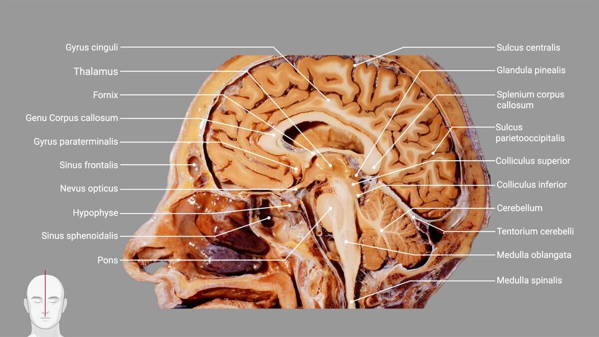 Kopfpräparat mit Beschriftung