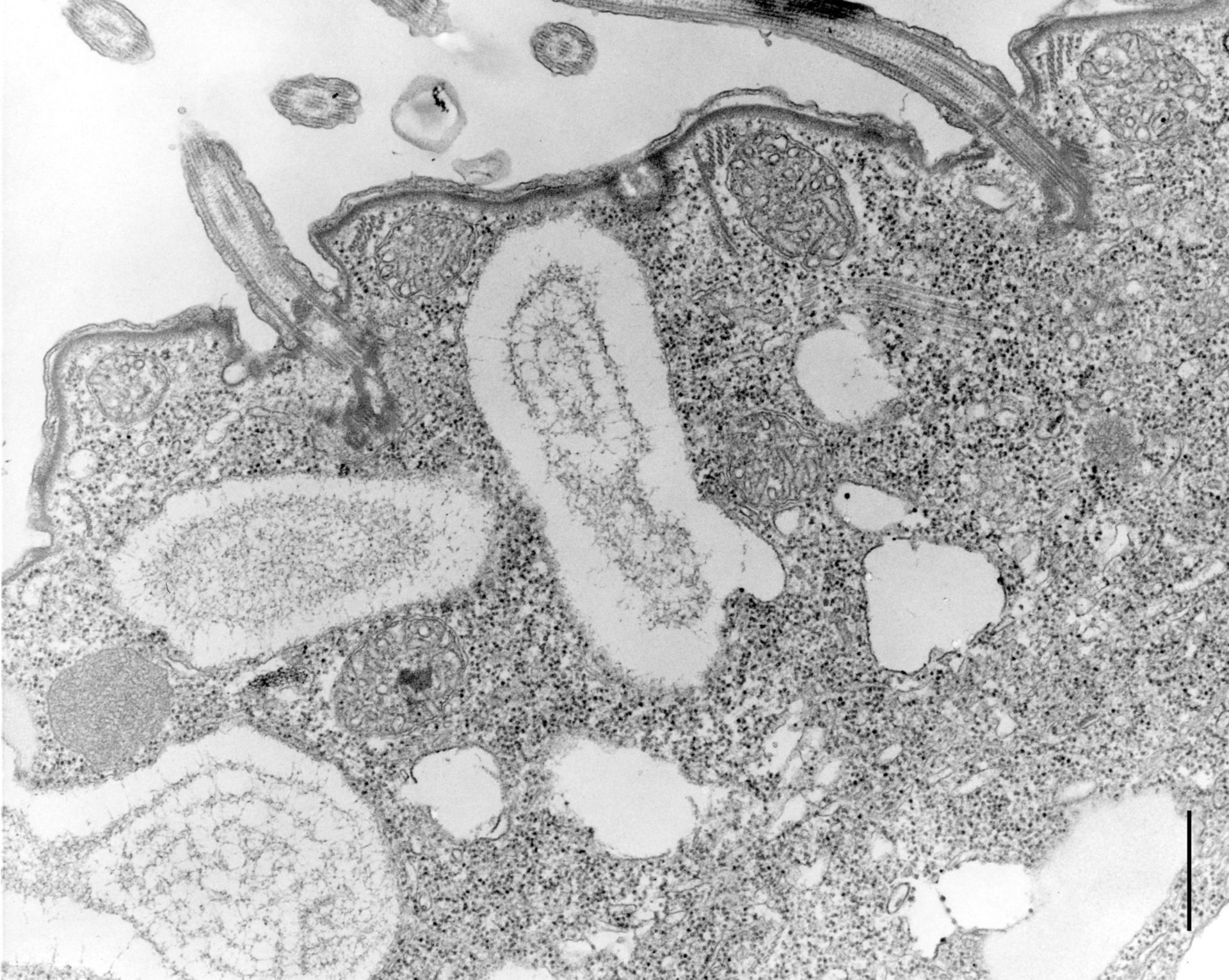 Colpoda cucullus (Cell cortex) - CIL:12108