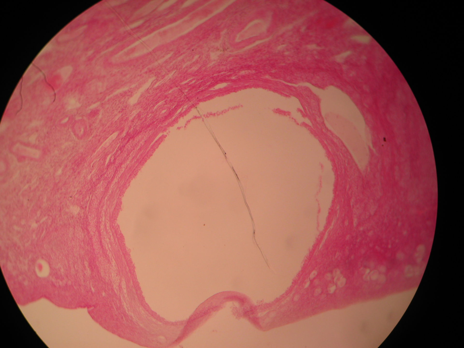 Veterinary Medicine: Ovary of a Cat (5)- Graaf-Follicle