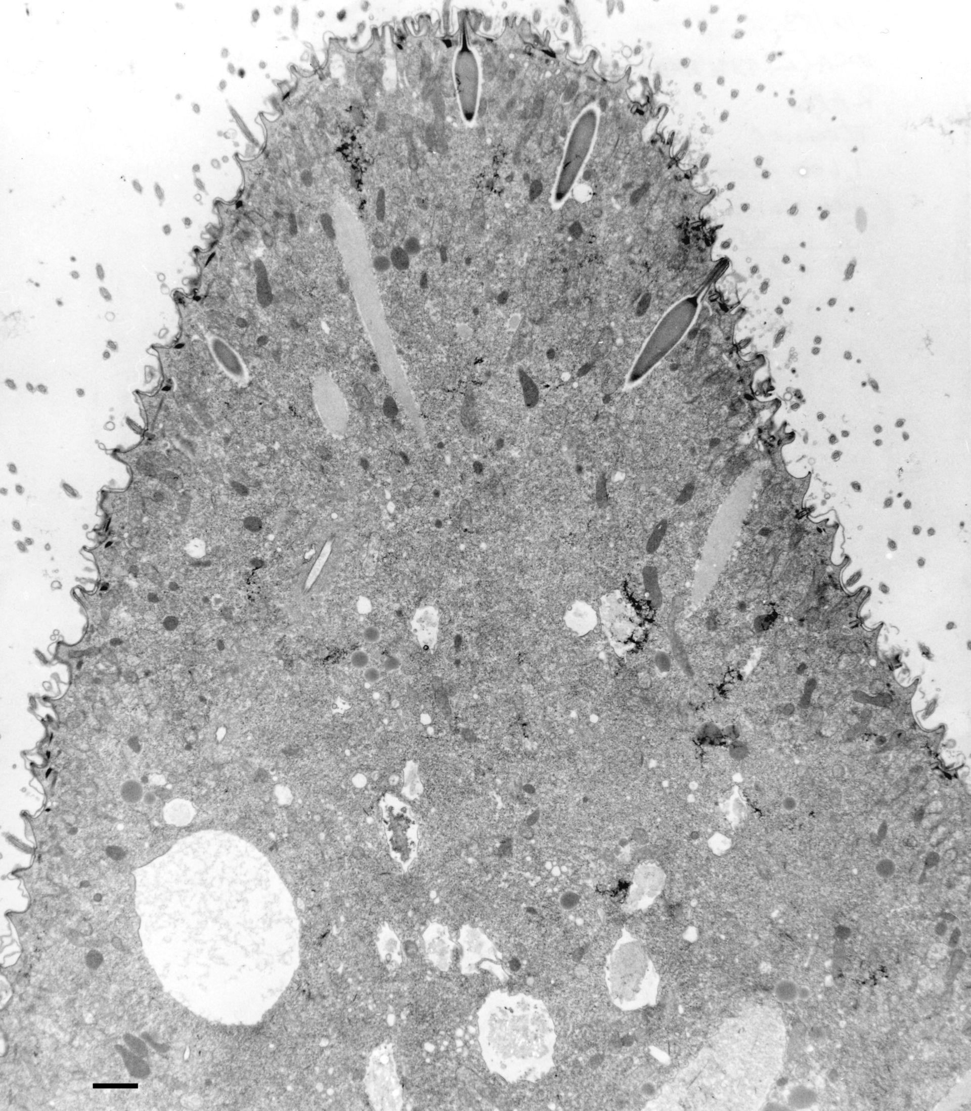 Paramecium multimicronucleatum (Trichocyst) - CIL:36666