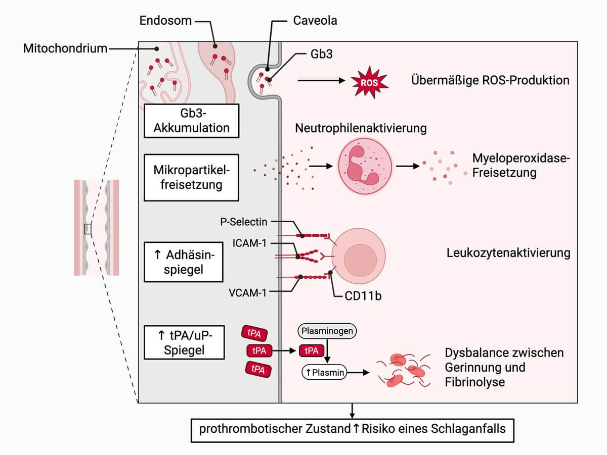 Pathogenese Morbus Fabry