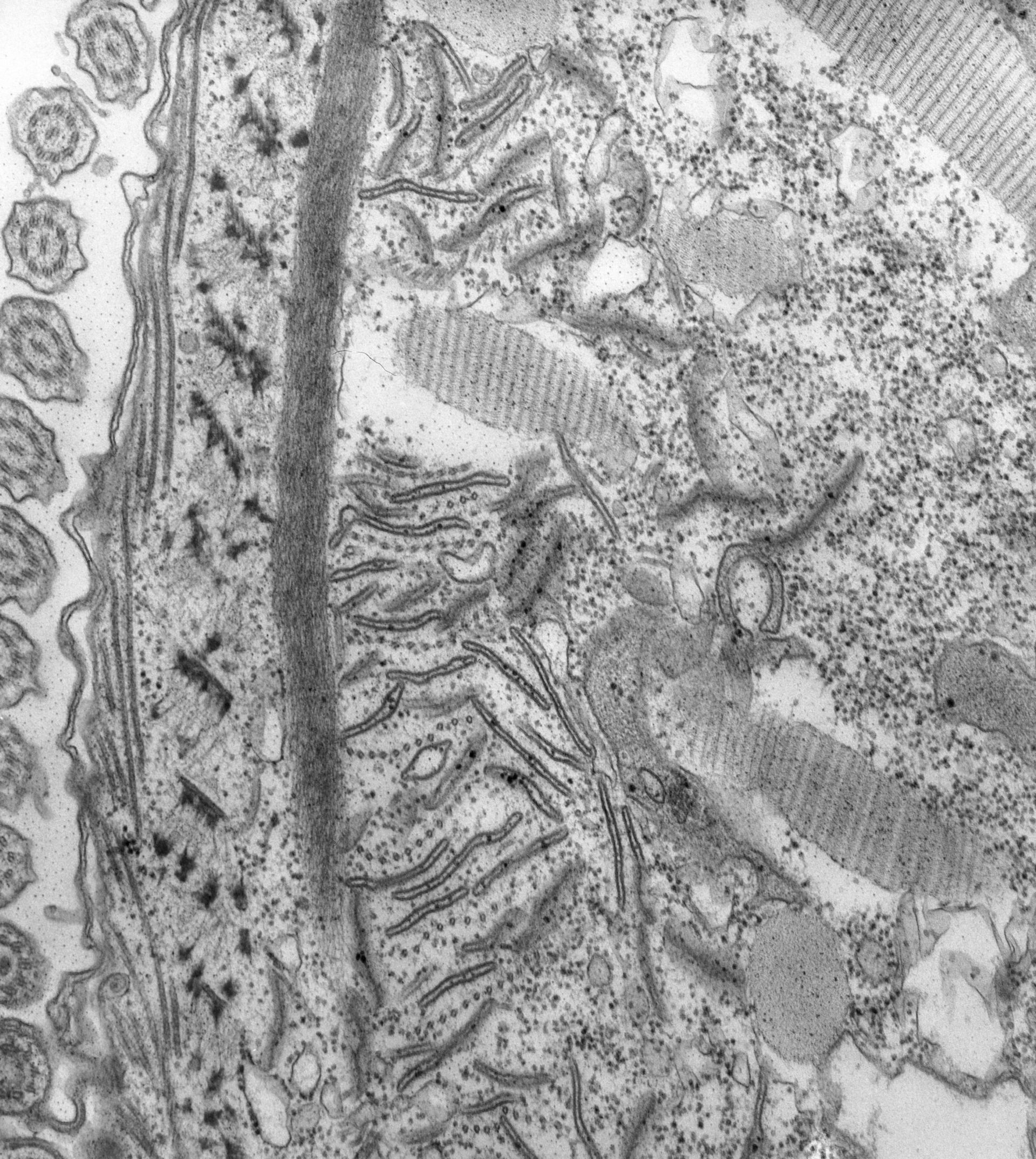 Paramecium caudatum (Microtubule associated complex) - CIL:39166