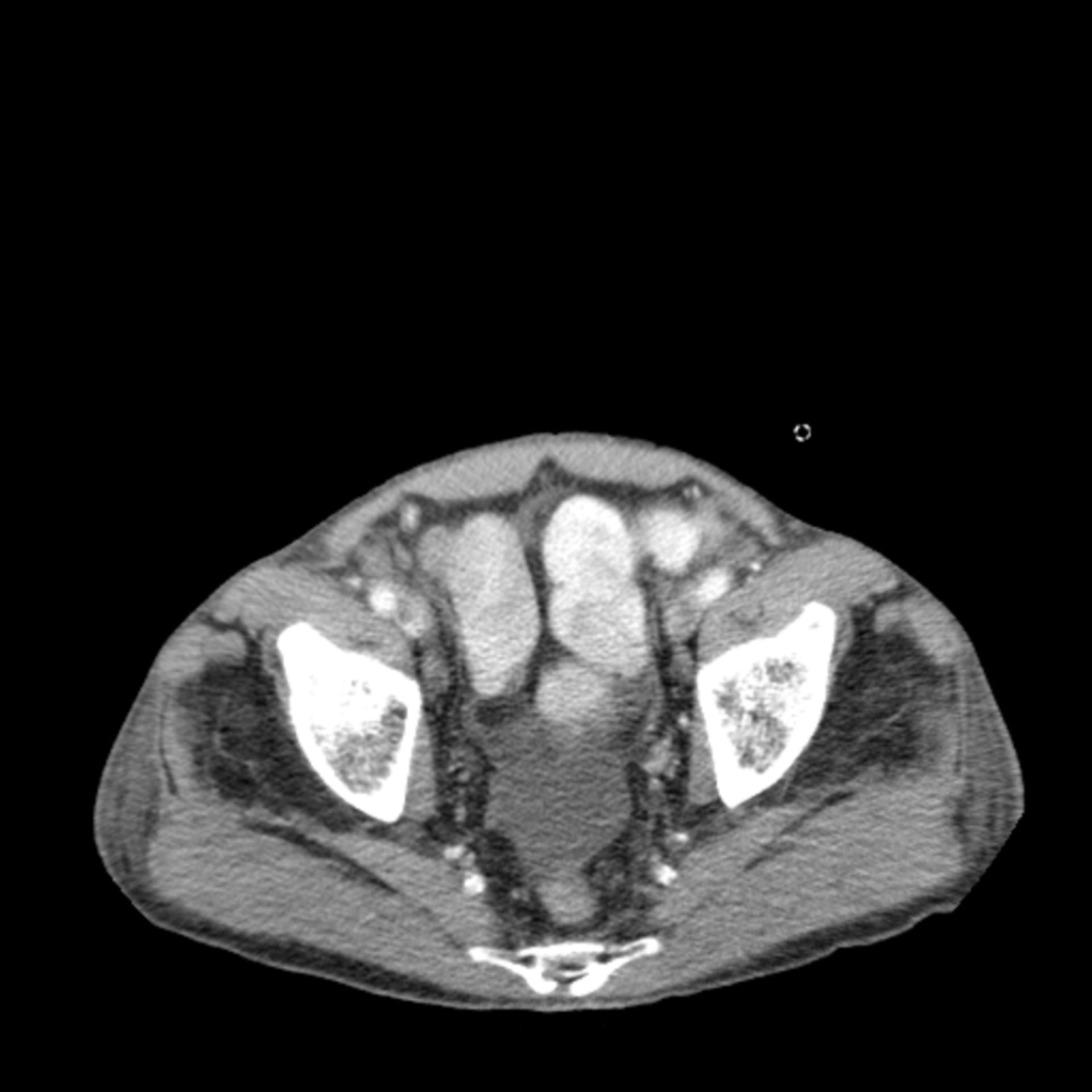 ct_tra9: CT des Abdomens in transversaler Ebene