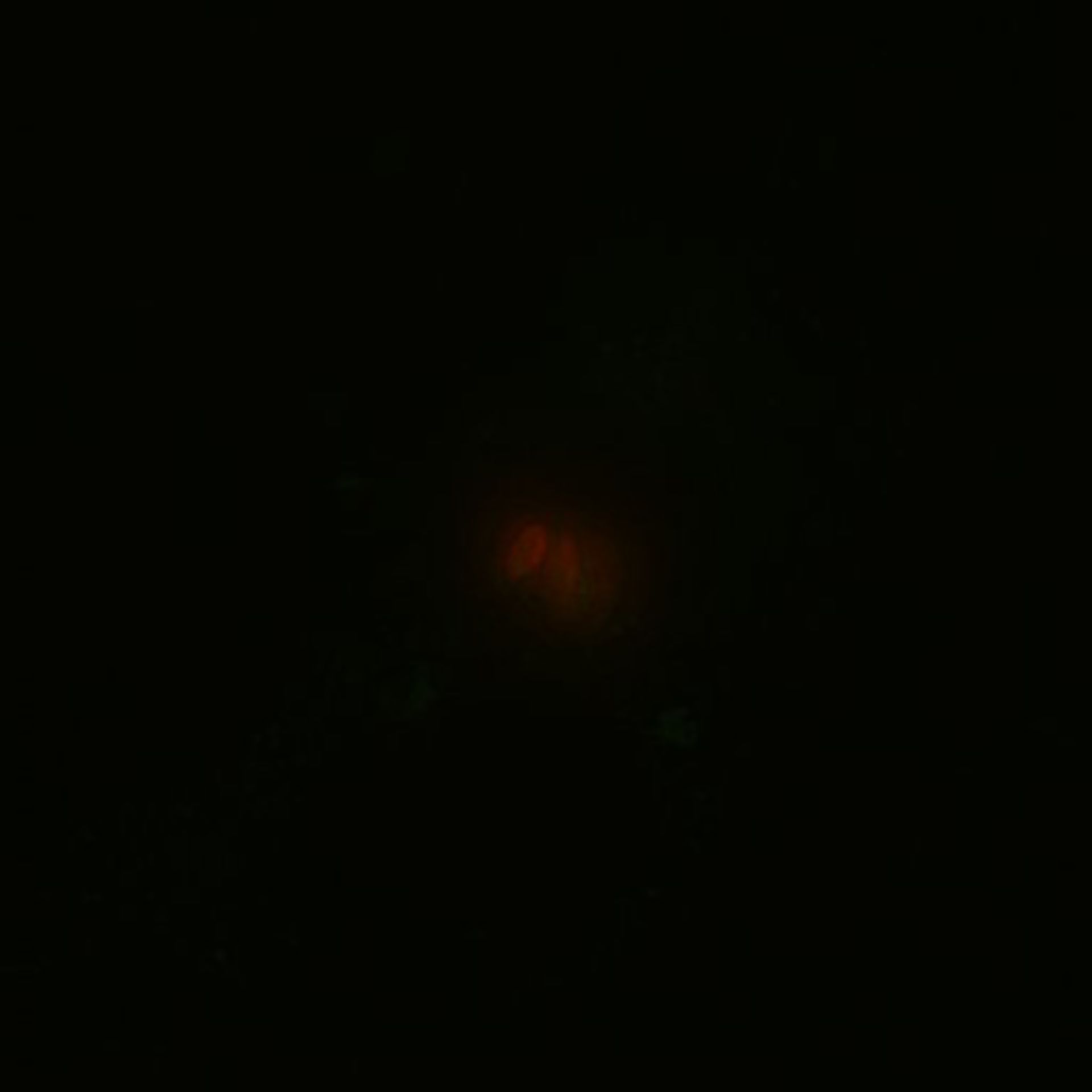 Toxoplasma gondii RH (Polar ring of apical complex) - CIL:10514