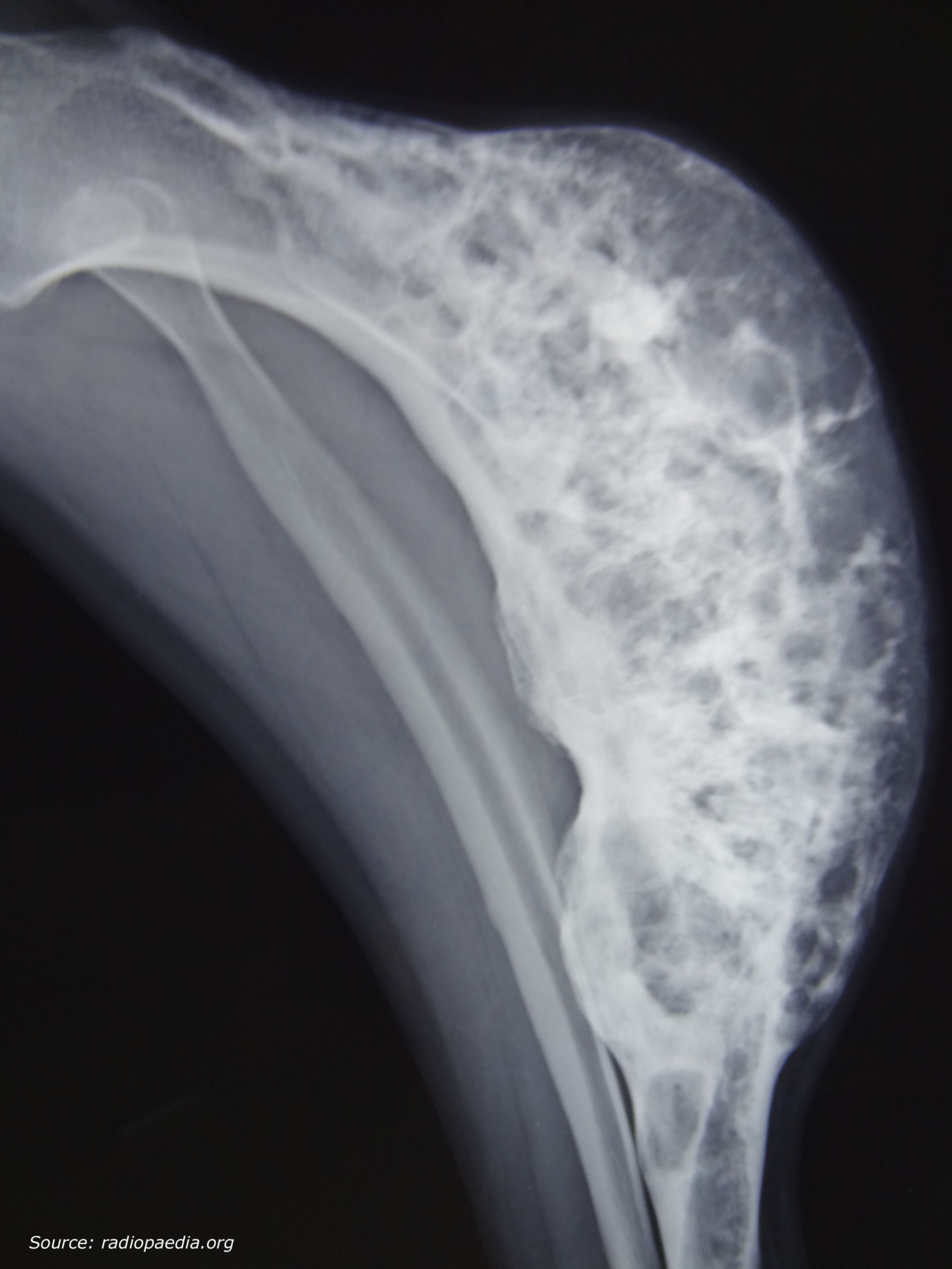 Röntgen linker Unterschenkel (1)
