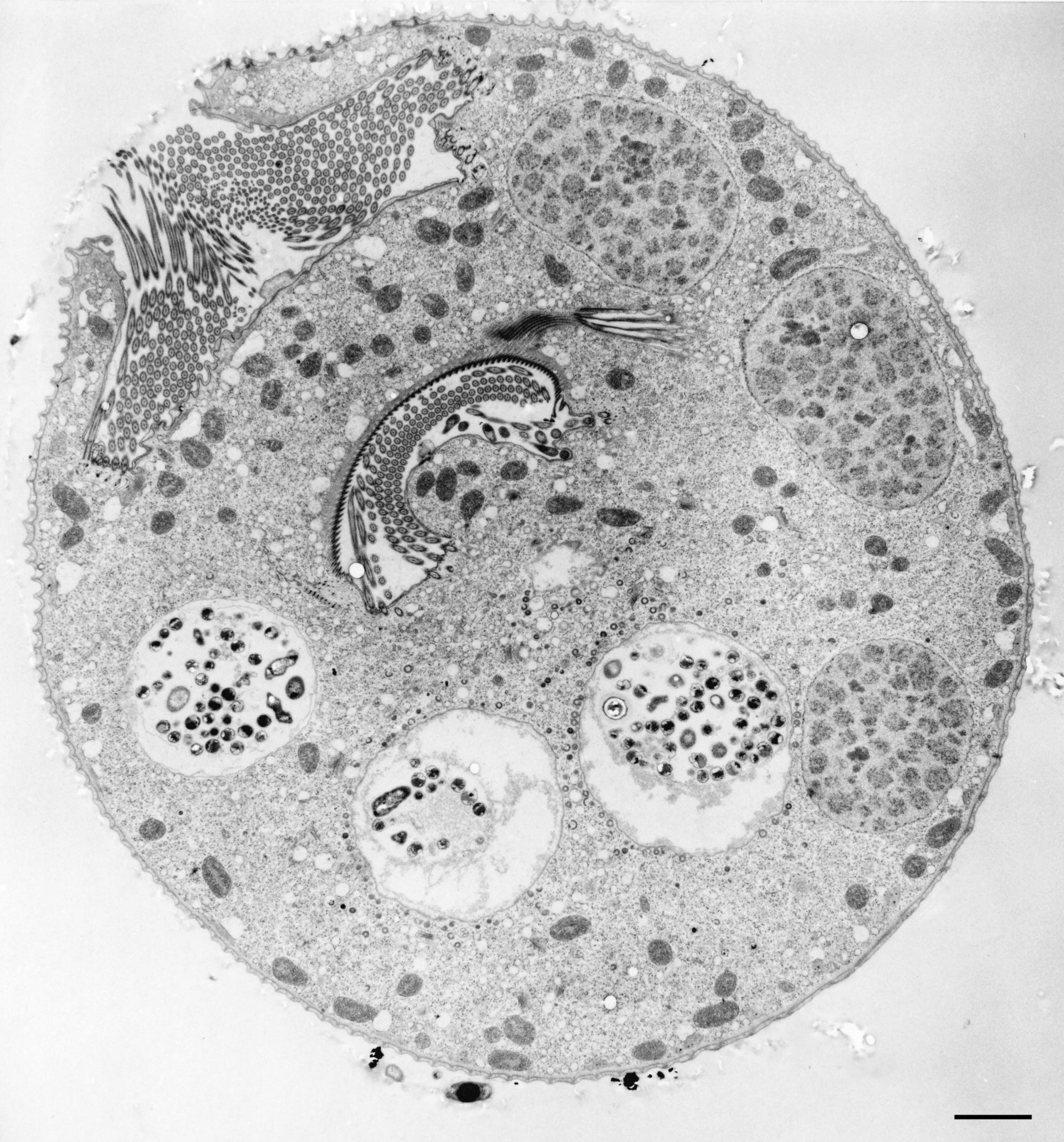 Vorticella convallaria (Oral apparatus) - CIL:36251