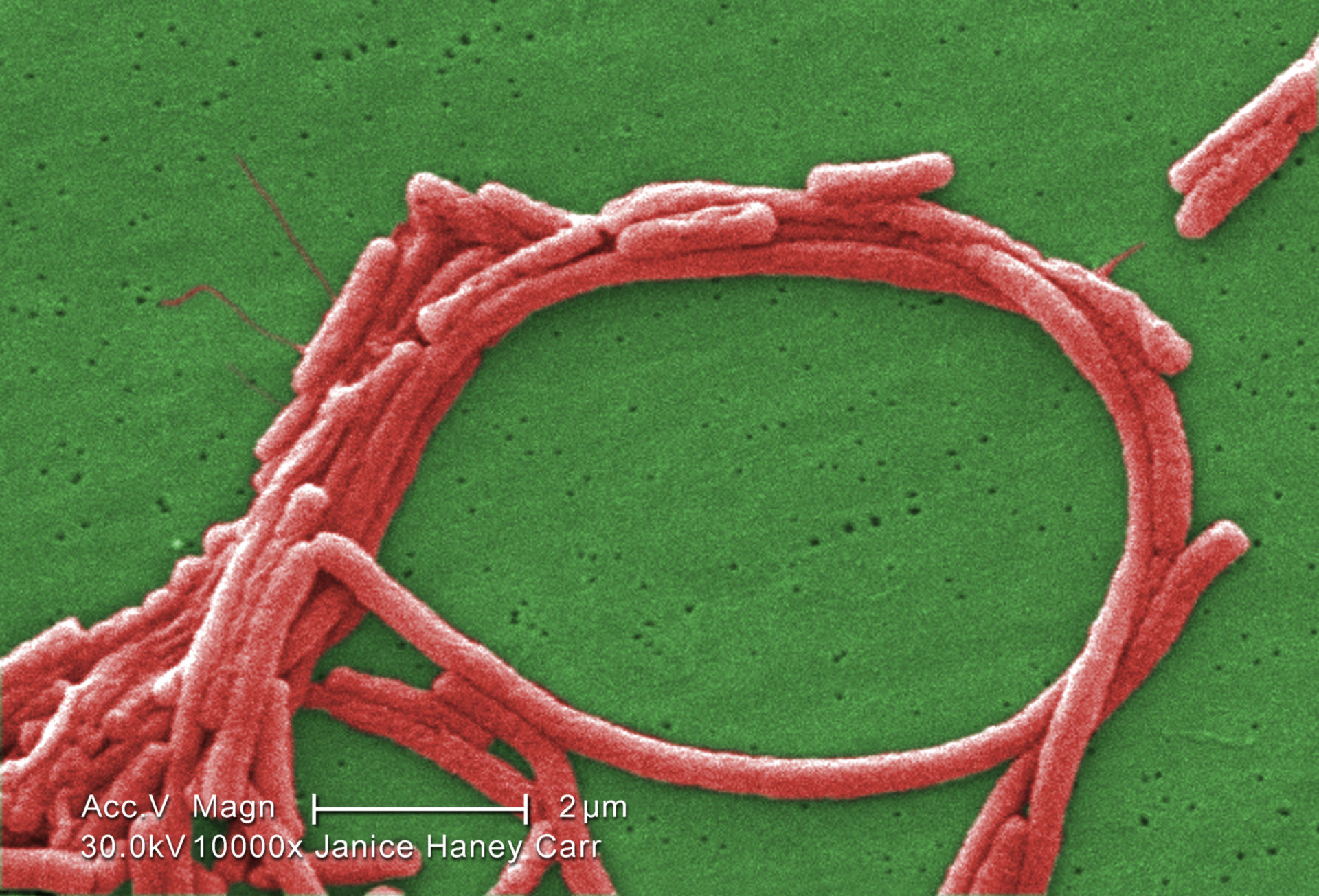 Legionella pneumophila (REM)