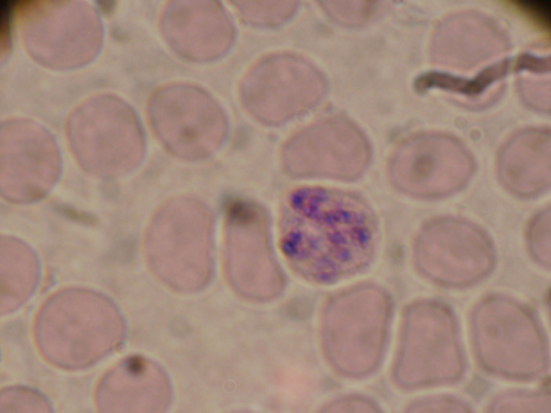 Plasmodium ovale schizonti