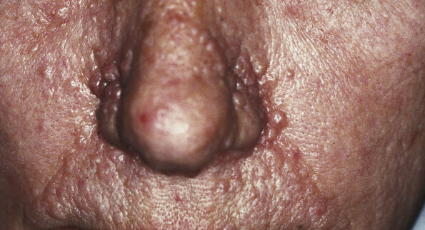 derm03_original.jpg