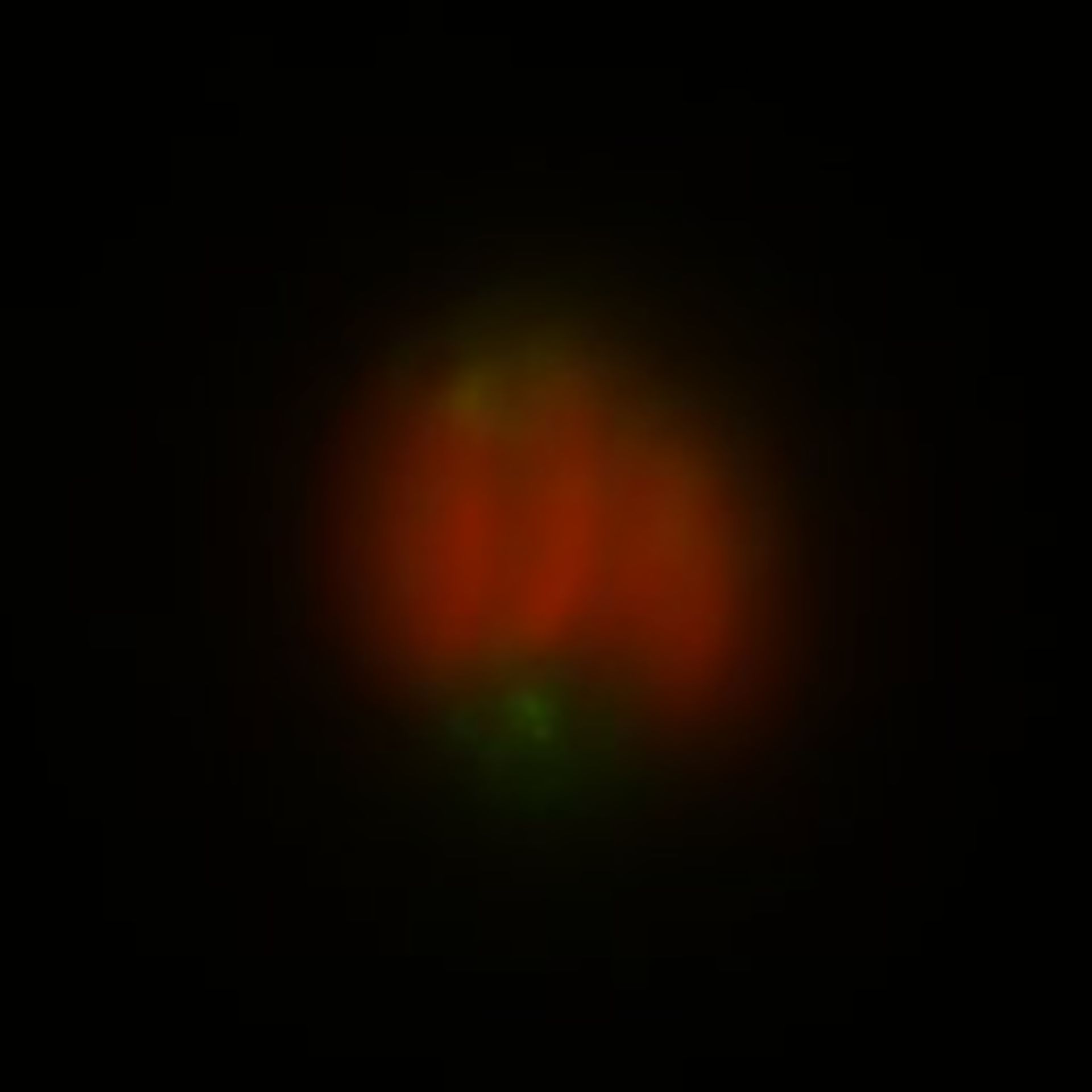 Toxoplasma gondii RH (Polar ring of apical complex) - CIL:10495