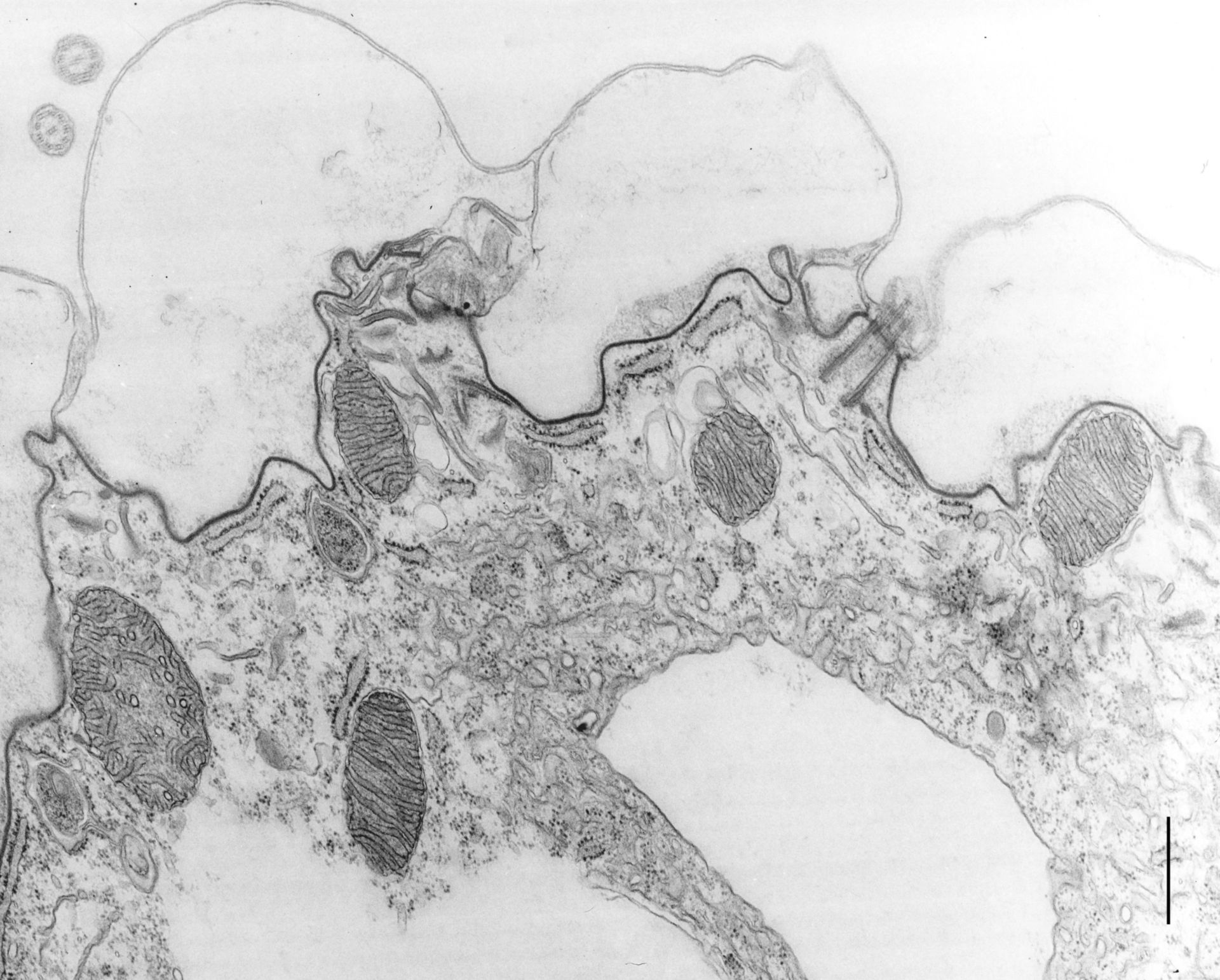 Coleps hirtus (Cortical membranes) - CIL:9699