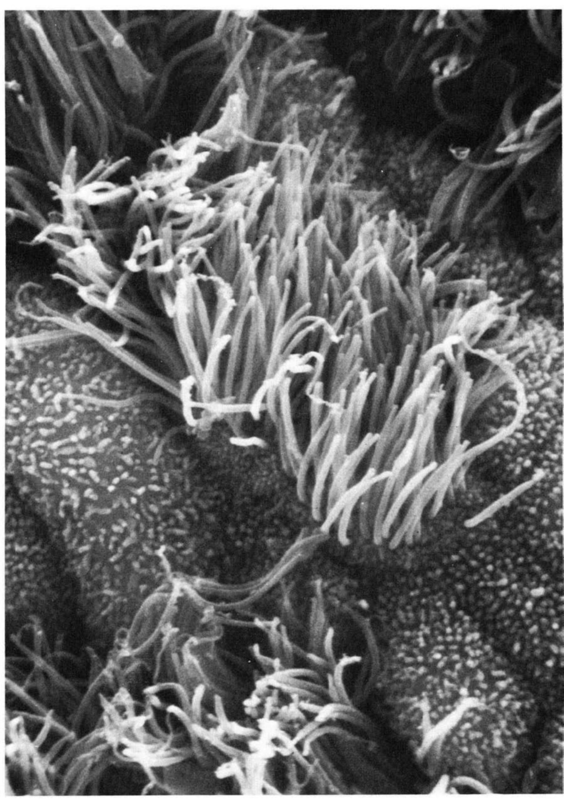 Cilia! Image of the Week – March 18, 2019 - CIL:11620 - http://www.cellimagelibrary.org/images/11620