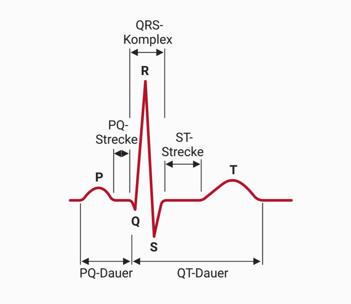 ECG EKG Practice Quiz Identify Rhythms 52 OFF