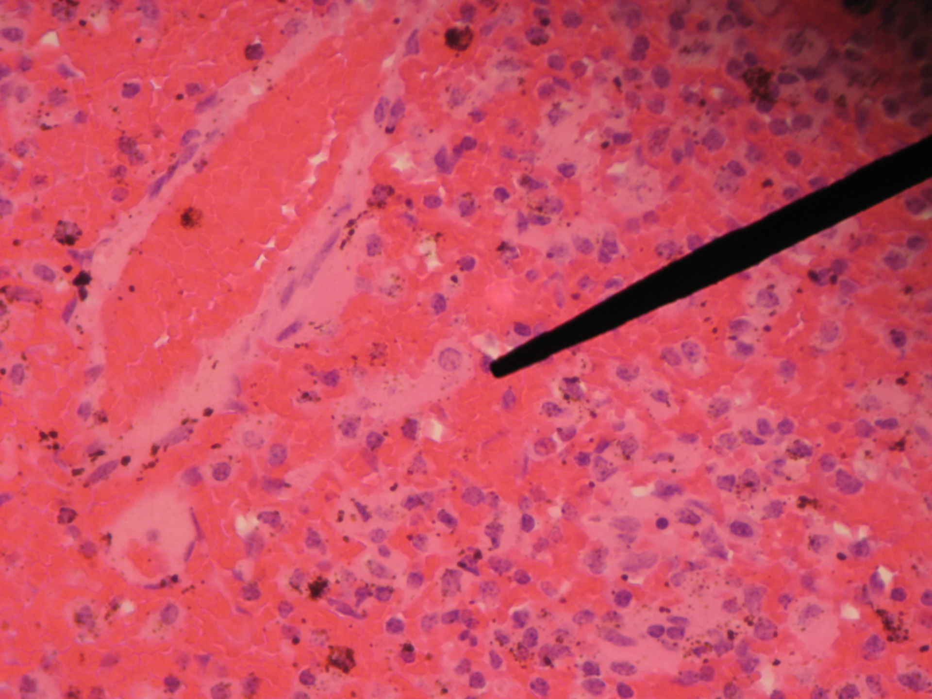 Spleen of a pig - red pulp, mcrophages, capillaries
