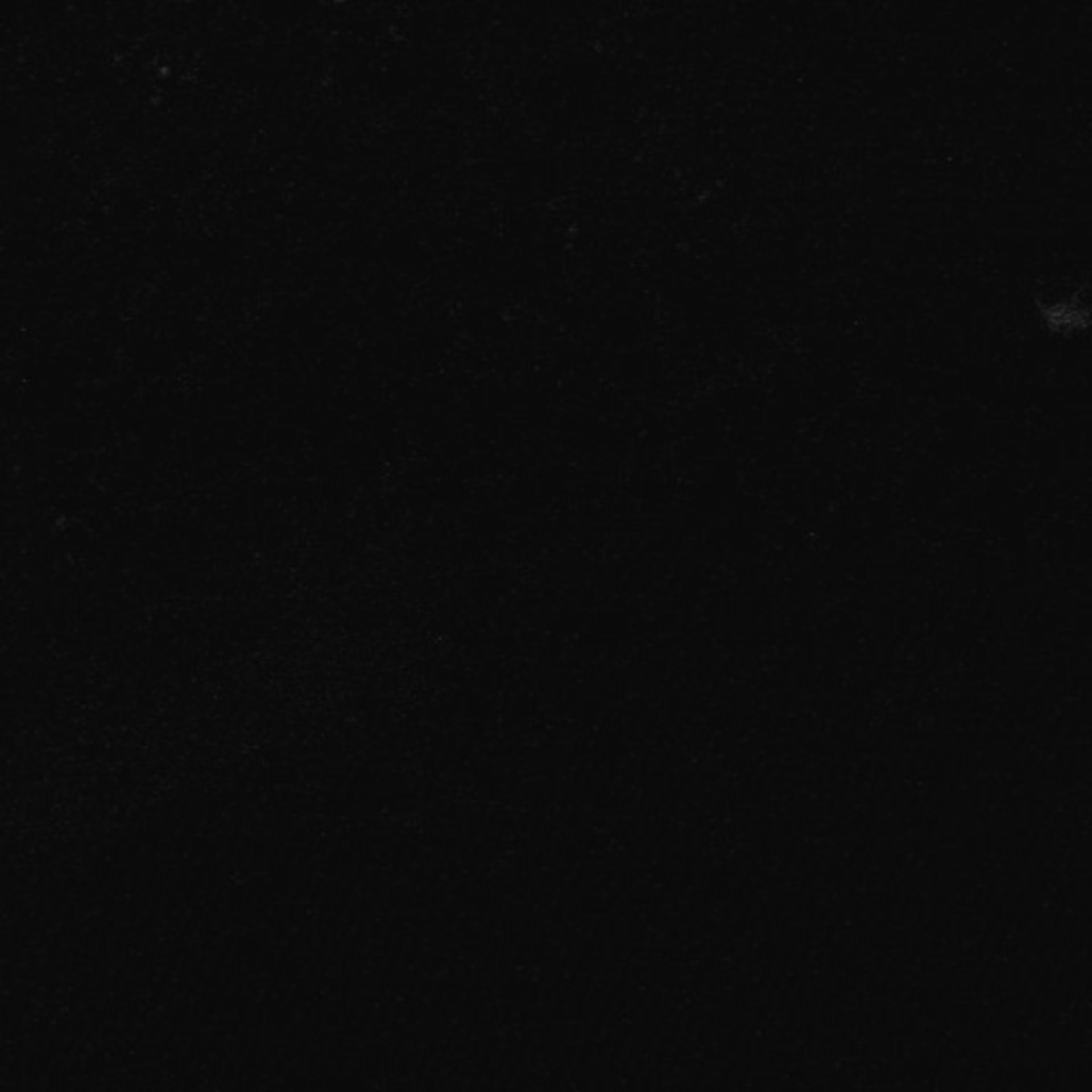 Xenopus laevis (Neuronal cell body) - CIL:36968