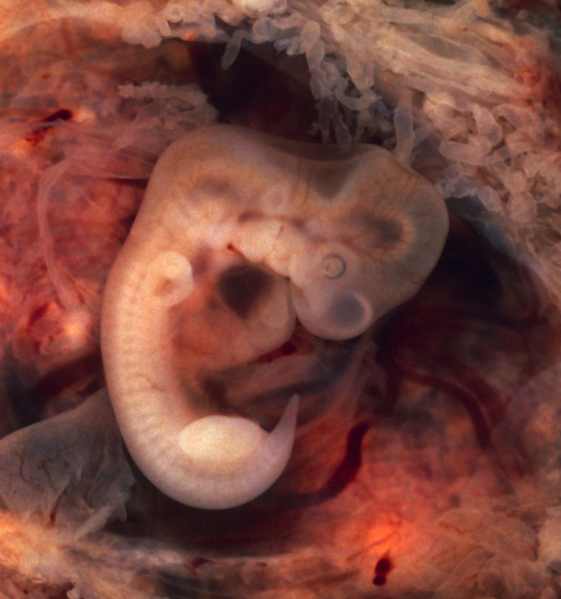 Embryo (5. Woche p.c., 7. SSW)
